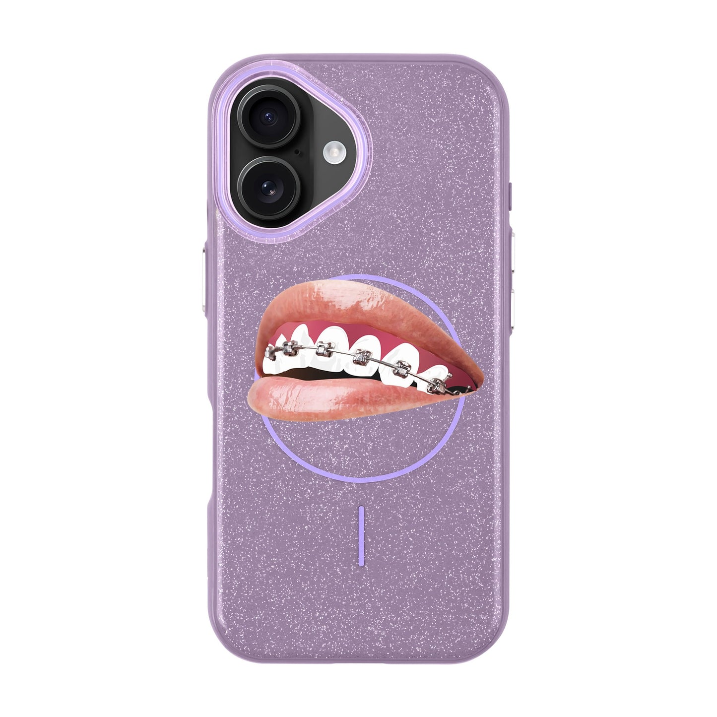 ORTHODONTIST-iPhone 16 Plus Radiant Kılıf MagSafe Özellikli
