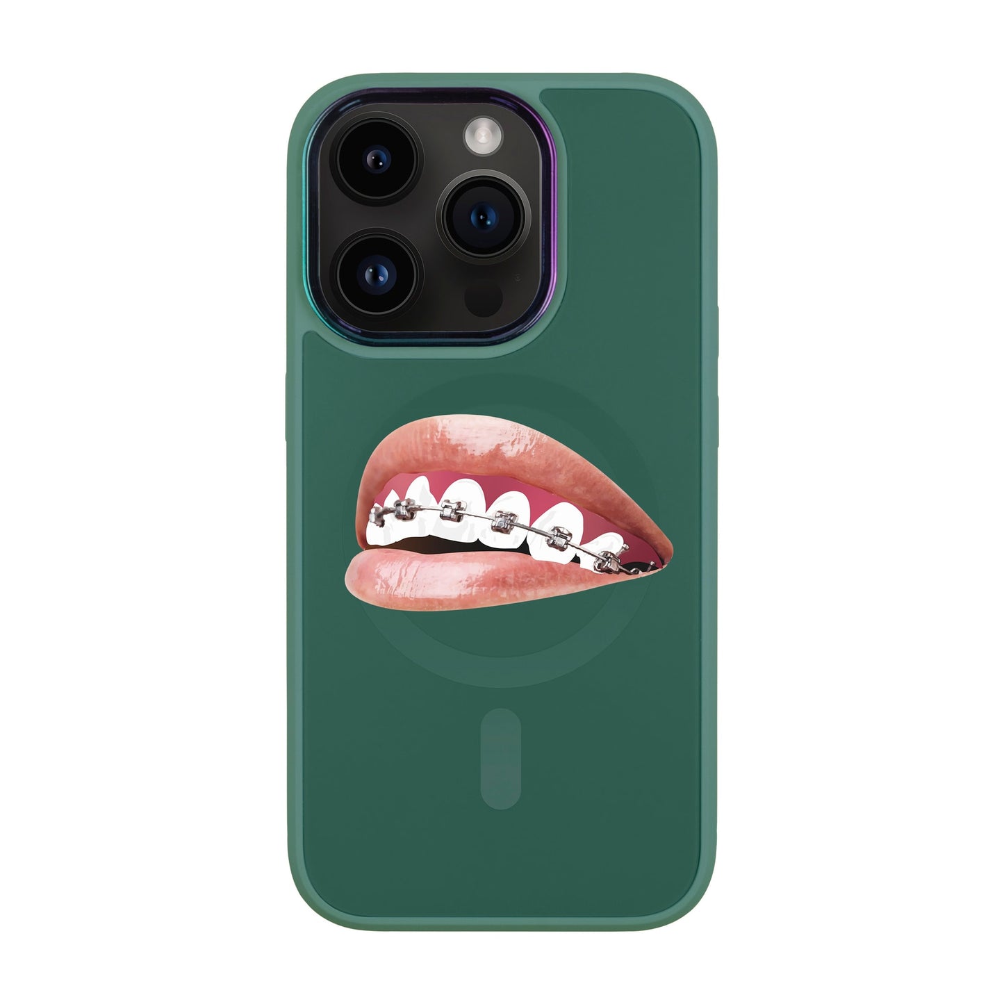 ORTHODONTİST-Vigor Kılıf MagSafe Özellikli - iPhone 14 Pro
