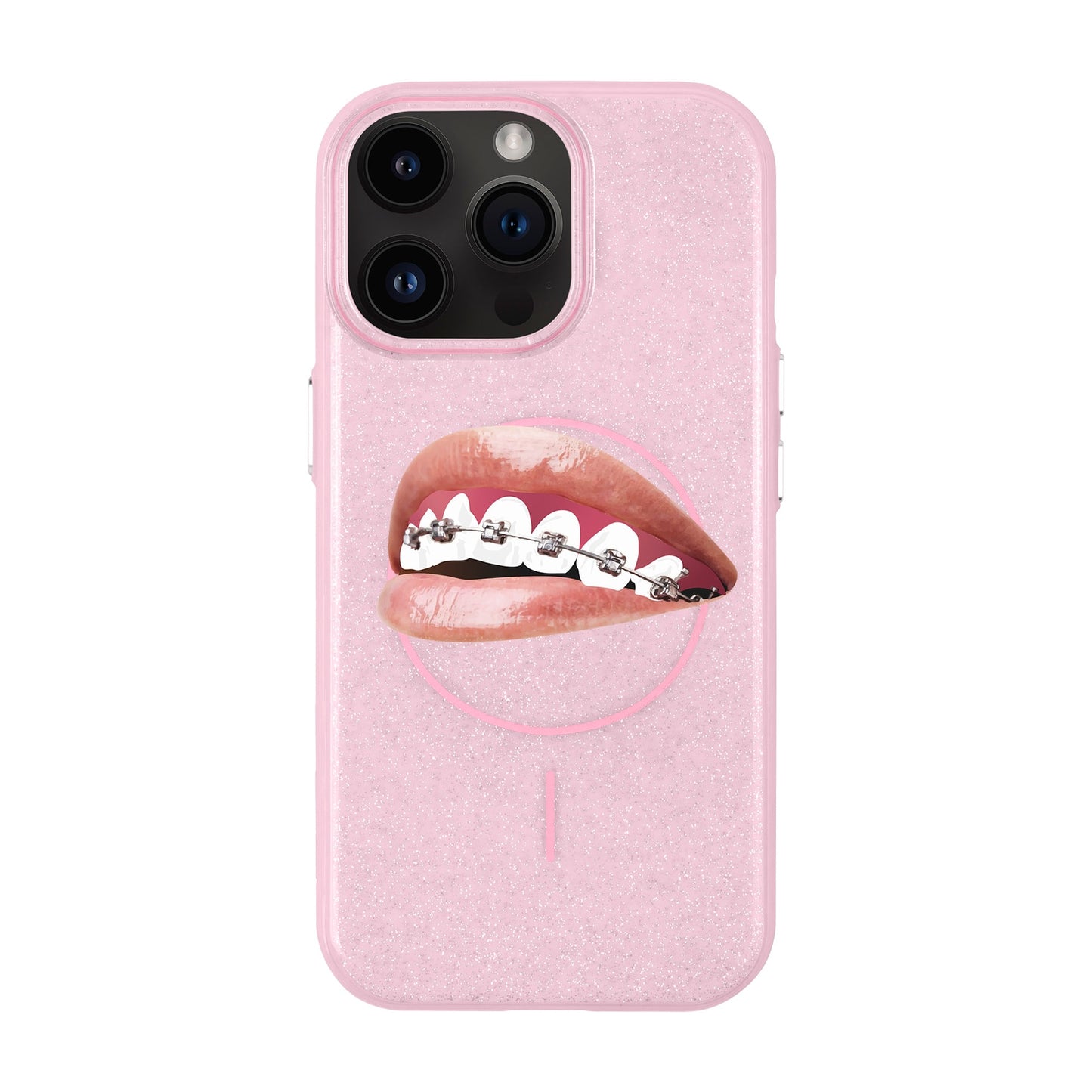 ORTHODONTIST-iPhone 14 Pro Max Radiant Kılıf MagSafe Özellikli