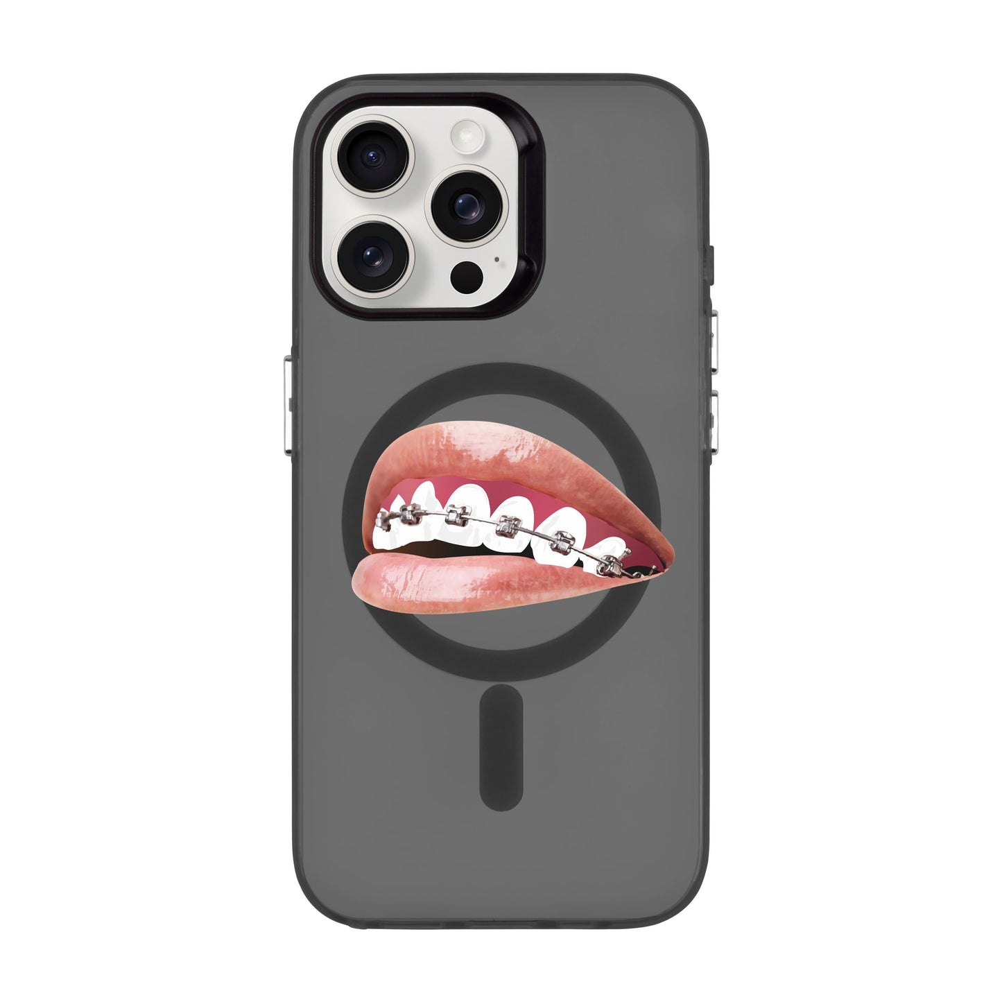 ORTHODONTIST-iPhone 15 Pro Max Hold Kılıf MagSafe Özellikli