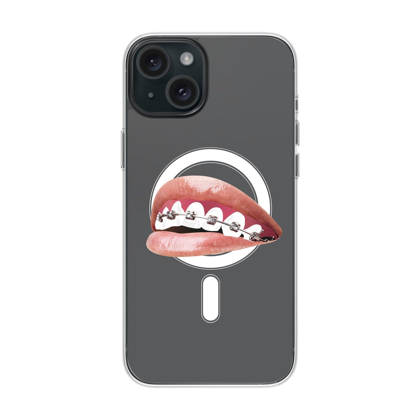 ORTHODONTIST-iPhone 15 Plus Solid Kılıf MagSafe Özellikli