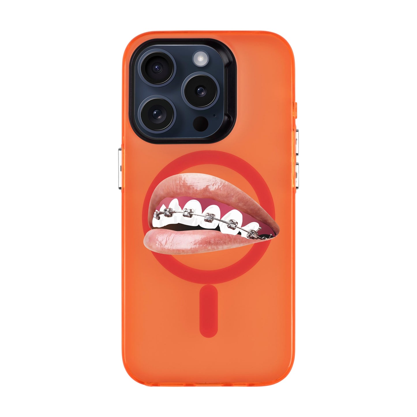 ORTHODONTIST-iPhone 15 Pro Hold Kılıf MagSafe Özellikli