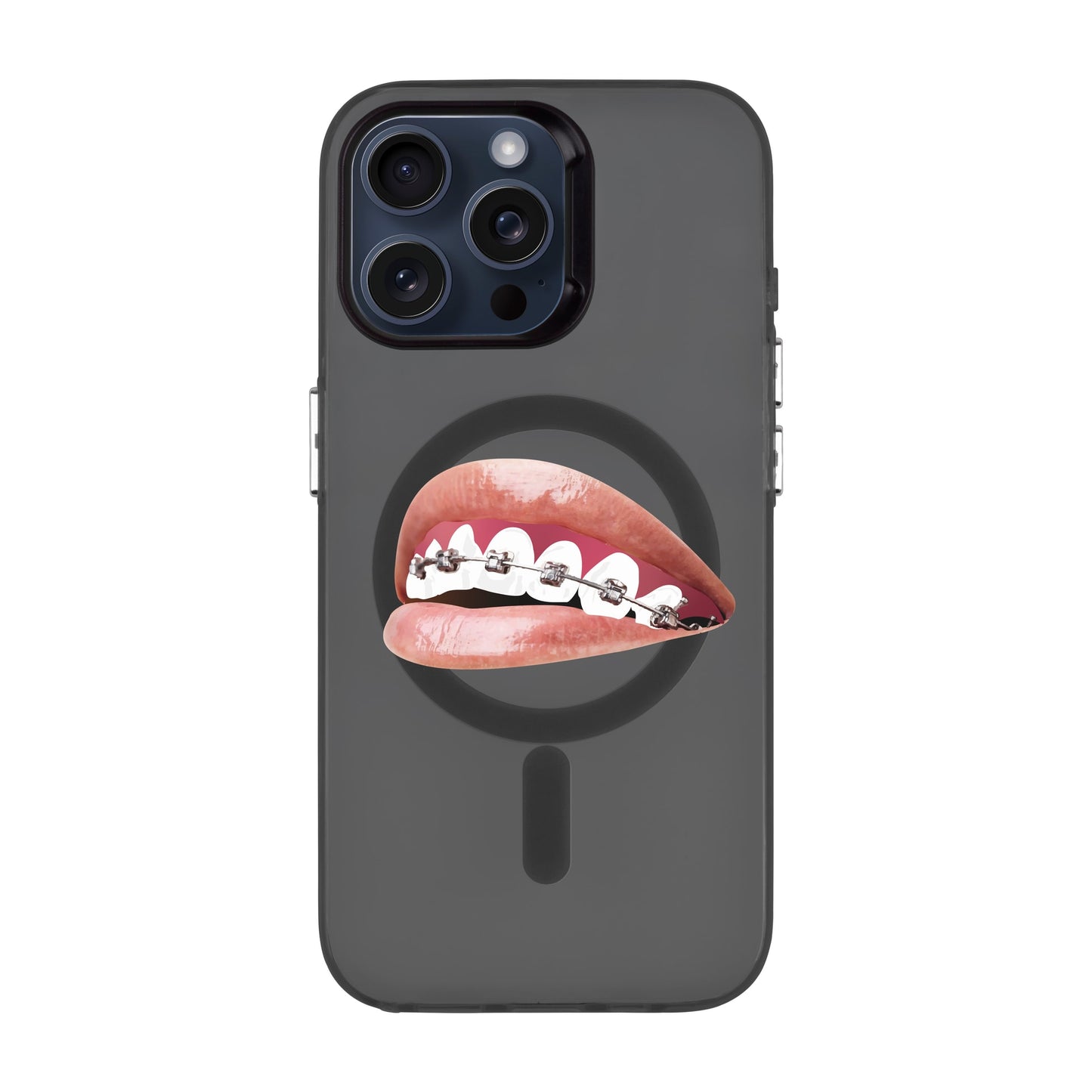 ORTHODONTIST-iPhone 15 Pro Max Hold Kılıf MagSafe Özellikli