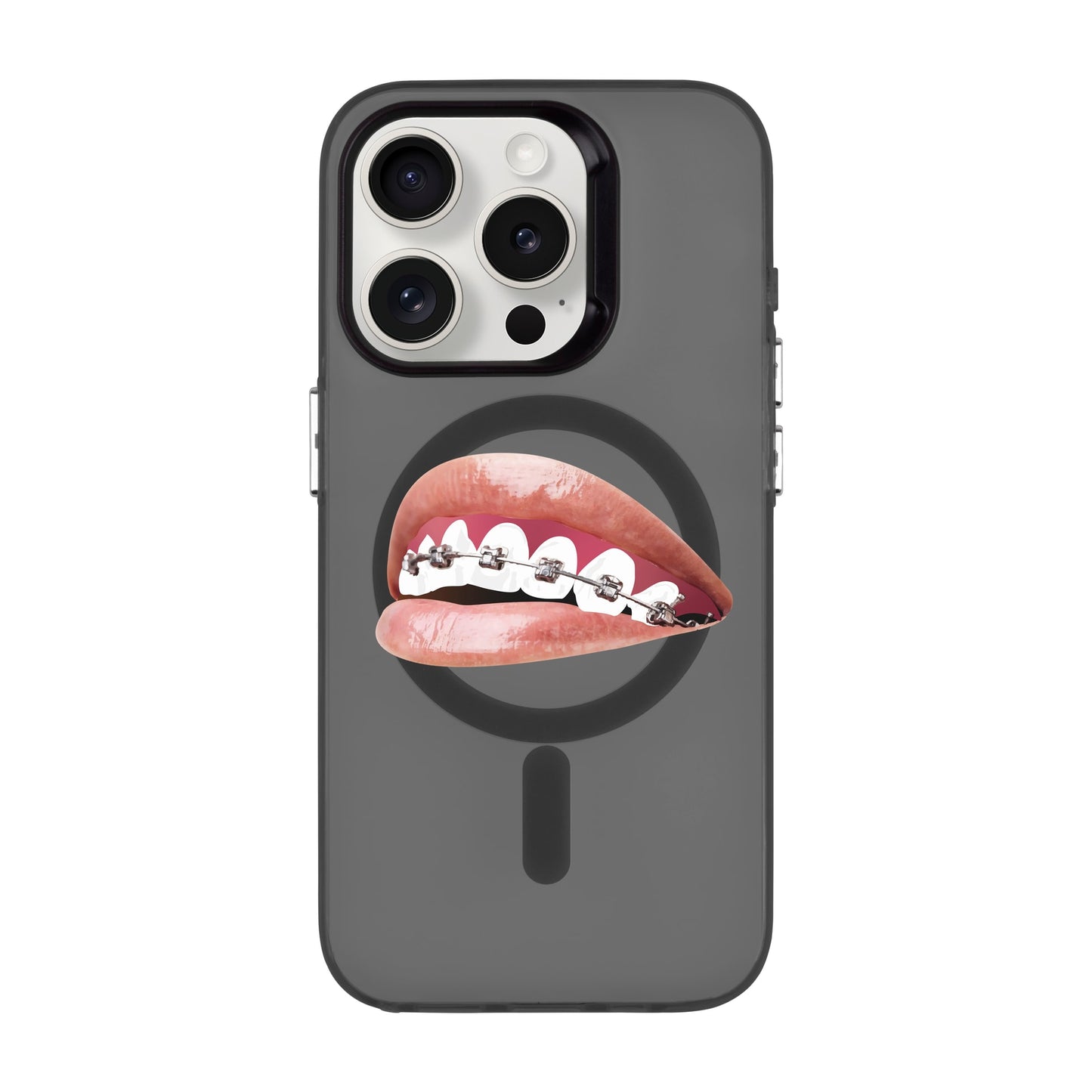 ORTHODONTIST-iPhone 15 Pro Hold Kılıf MagSafe Özellikli