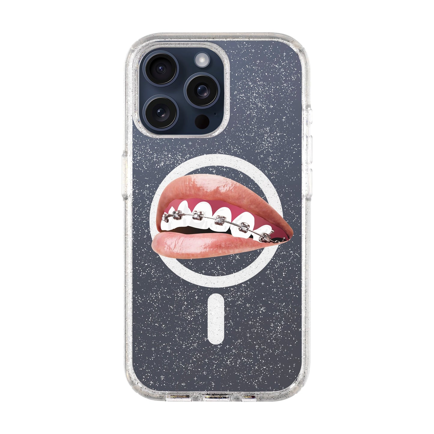 ORTHODONTIST-iPhone 15 Pro Max Shiny Kılıf MagSafe Özellikli