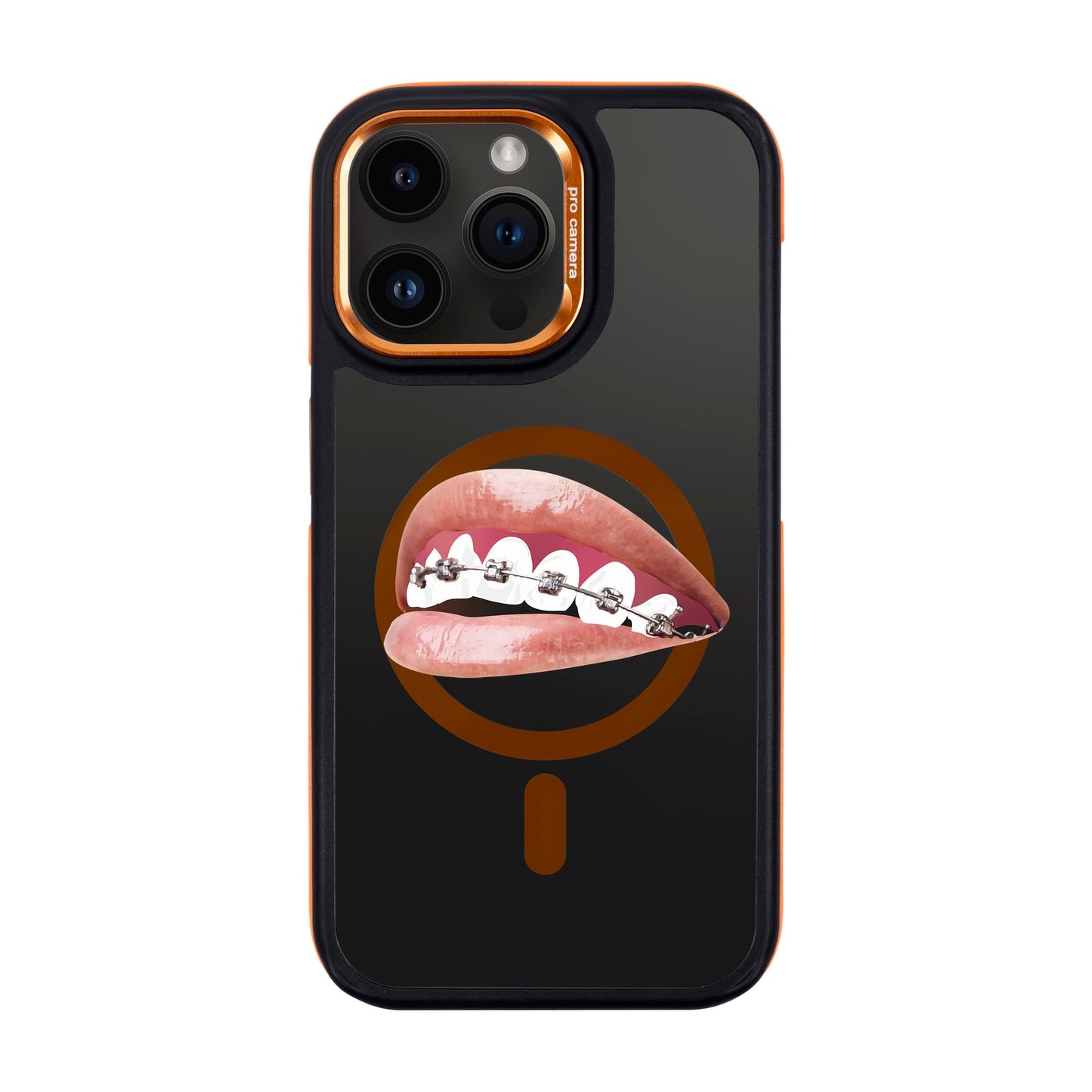 ORTHODONTIST-iPhone 14 Pro Max Dark Kılıf MagSafe Özellikli