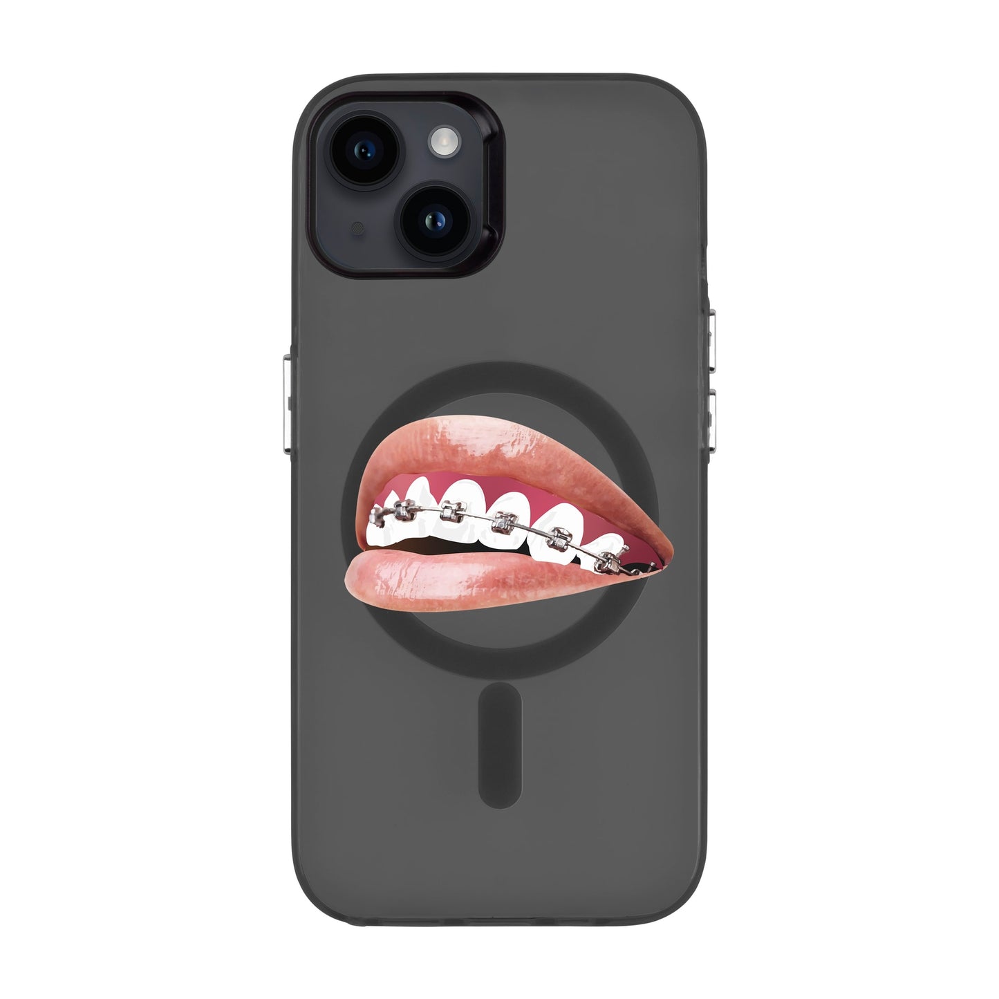 ORTHODONTIST-iPhone 14 Plus Hold Kılıf MagSafe Özellikli