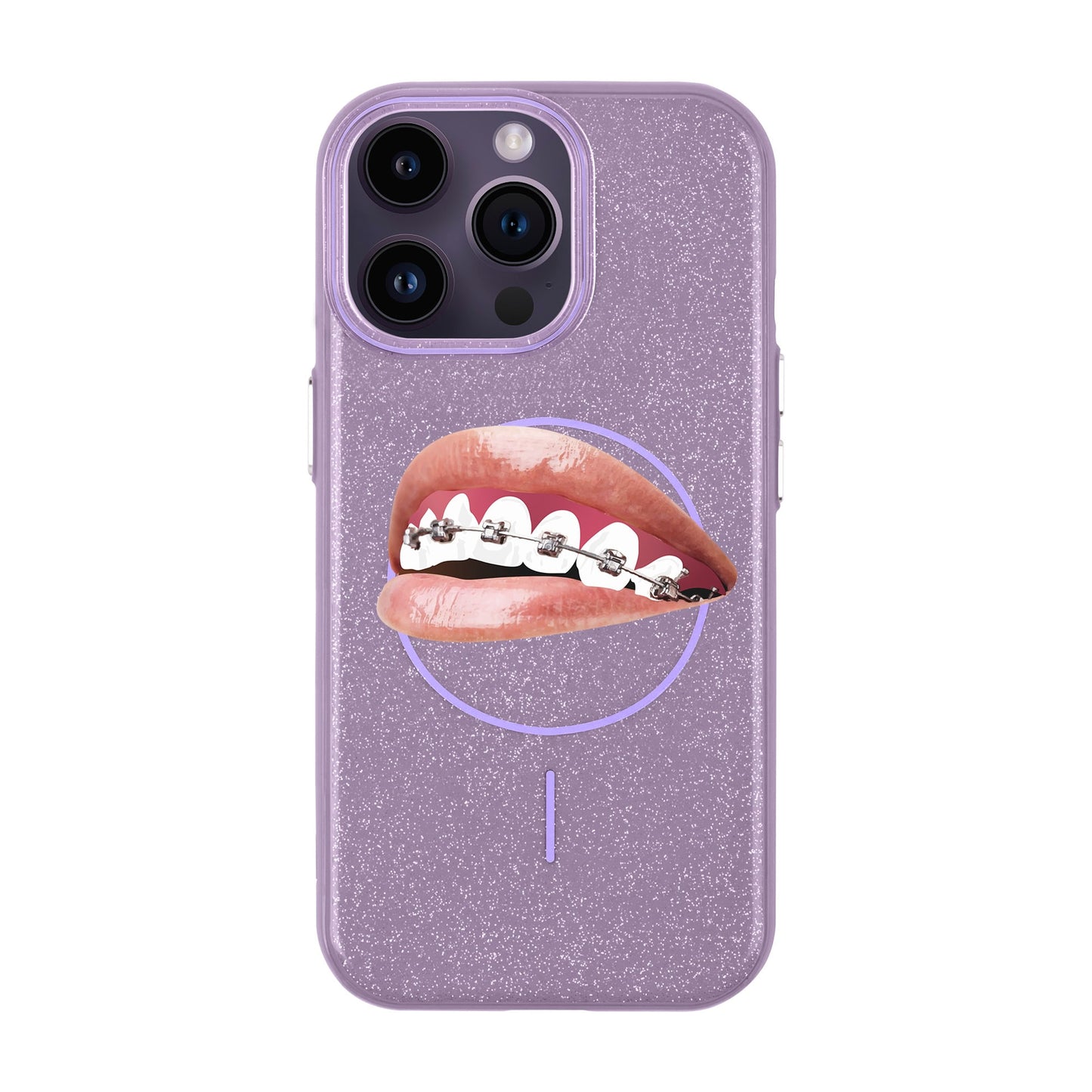 ORTHODONTIST-iPhone 14 Pro Max Radiant Kılıf MagSafe Özellikli