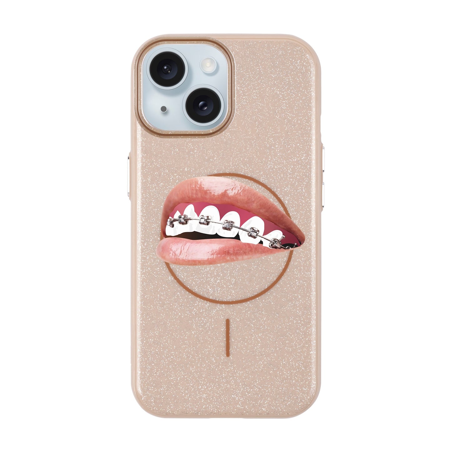 ORTHODONTIST-iPhone 15 Plus Radiant Kılıf MagSafe Özellikli