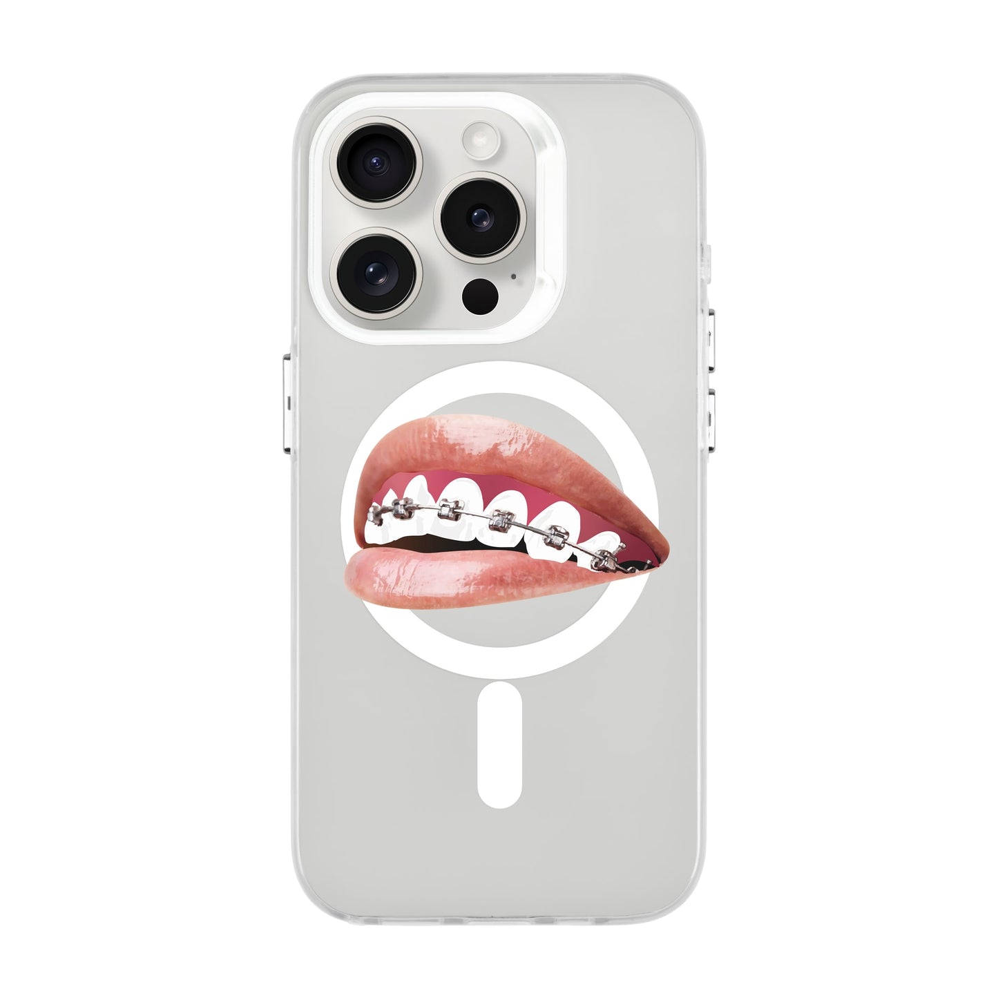ORTHODONTIST-iPhone 15 Pro Hold Kılıf MagSafe Özellikli