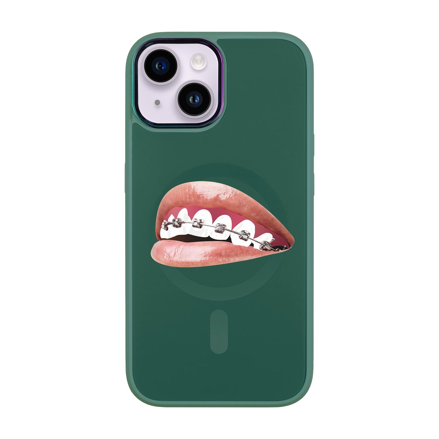ORTHODONTİST-iPhone 12 Vigor Kılıf MagSafe Özellikli