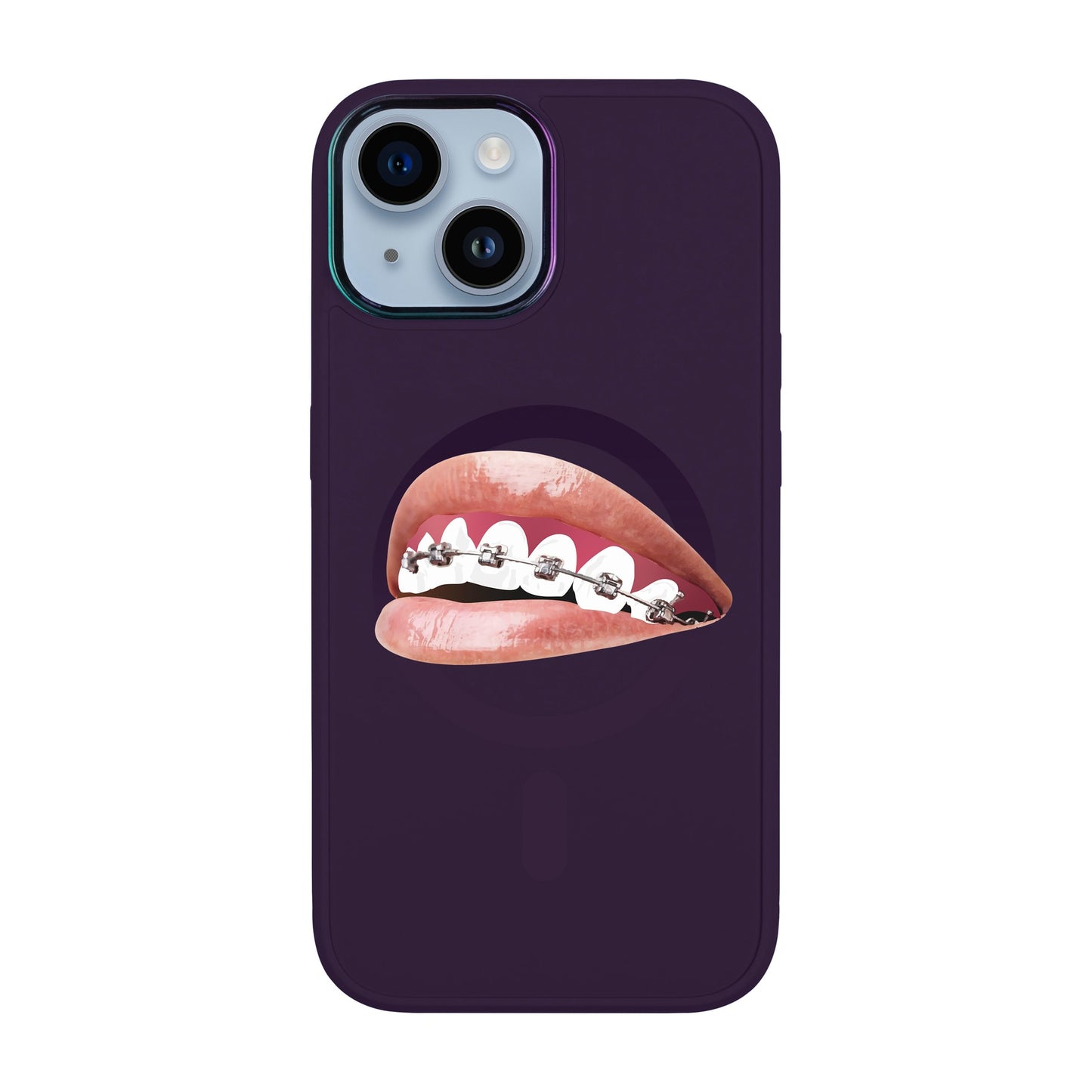 ORTHODONTİST-iPhone 12 Vigor Kılıf MagSafe Özellikli