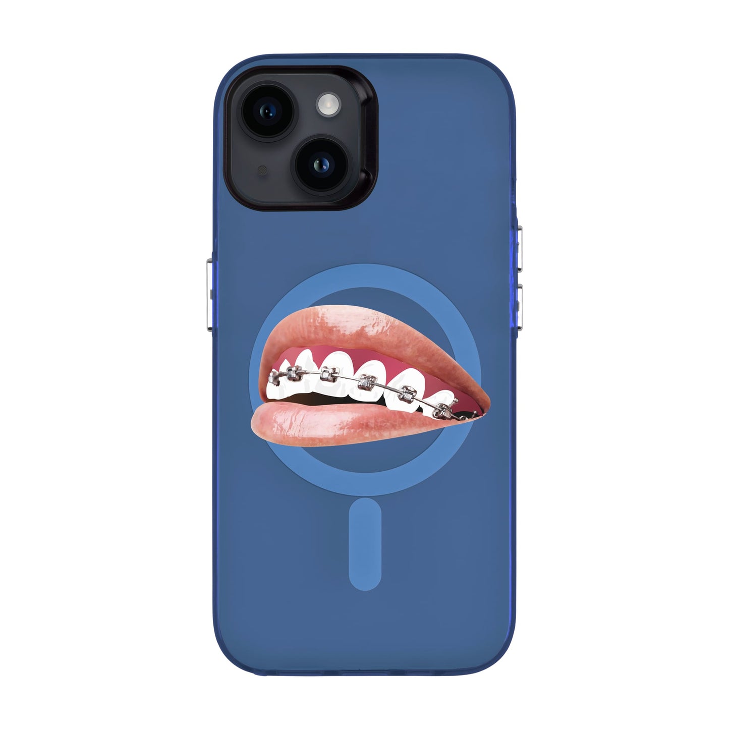 ORTHODONTIST-iPhone 14 Hold Kılıf MagSafe Özellikli