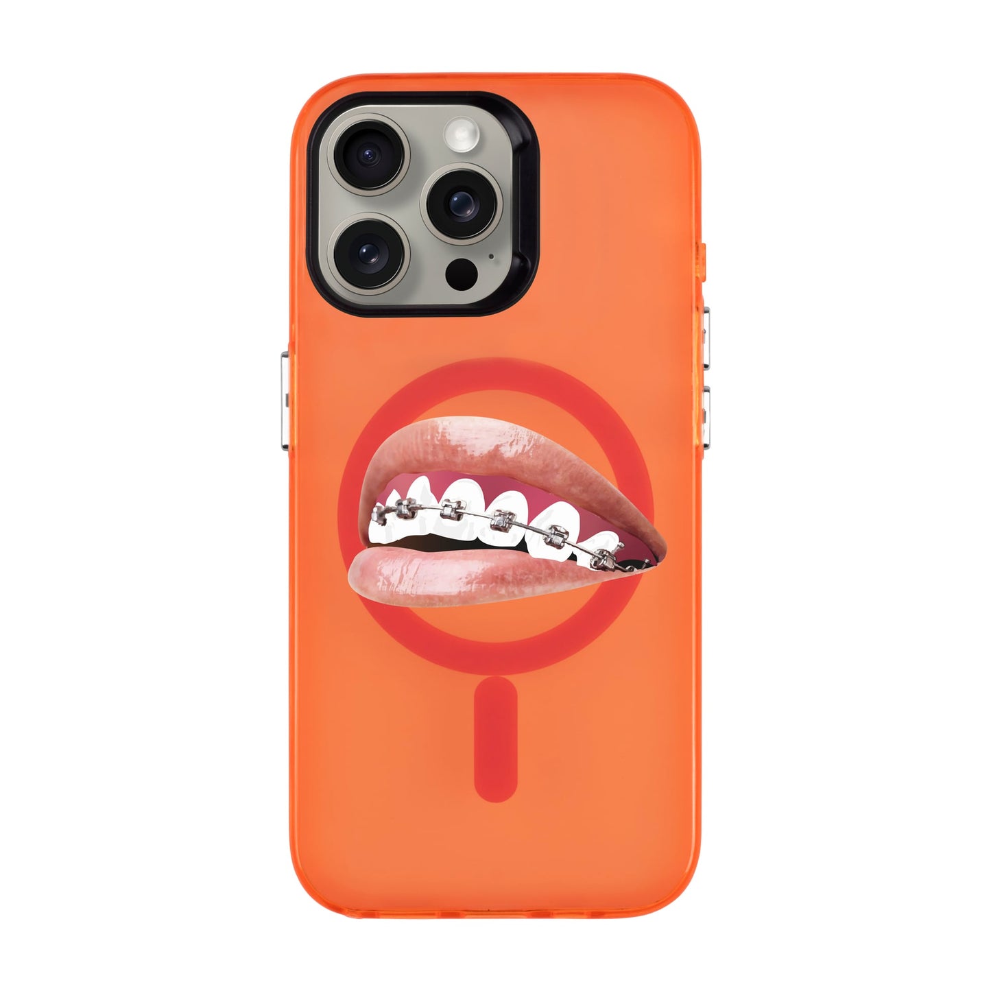ORTHODONTIST-iPhone 15 Pro Max Hold Kılıf MagSafe Özellikli