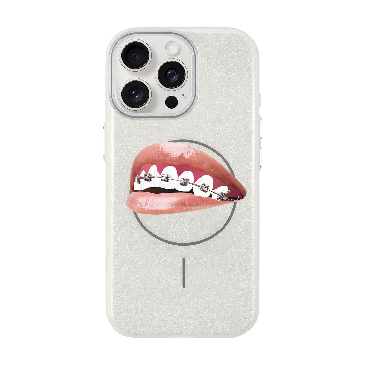 ORTHODONTIST-iPhone 15 Pro Max Radiant Kılıf MagSafe Özellikli