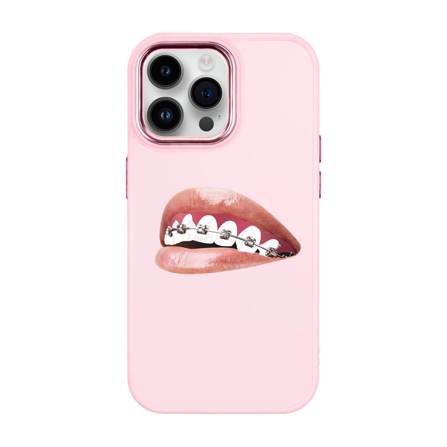 ORTHODONTIST-iPhone 14 Pro Max Proof Kılıf