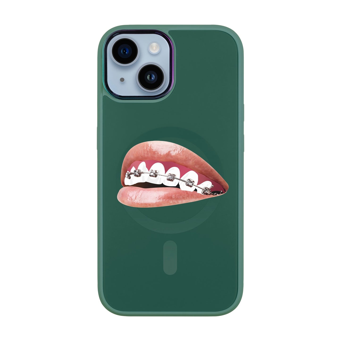 ORTHODONTİST-iPhone 12 Vigor Kılıf MagSafe Özellikli