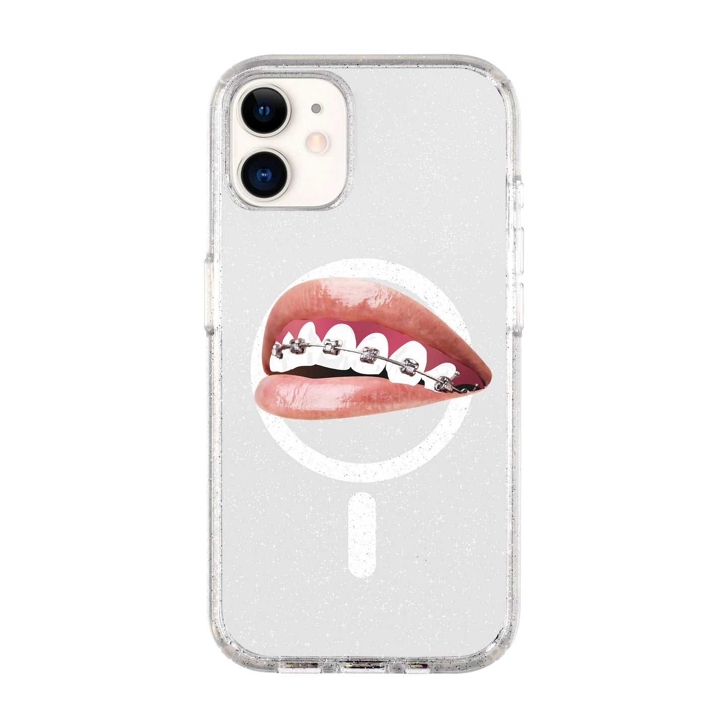ORTHODONTIST-iPhone 11 Shiny Kılıf MagSafe Özellikli