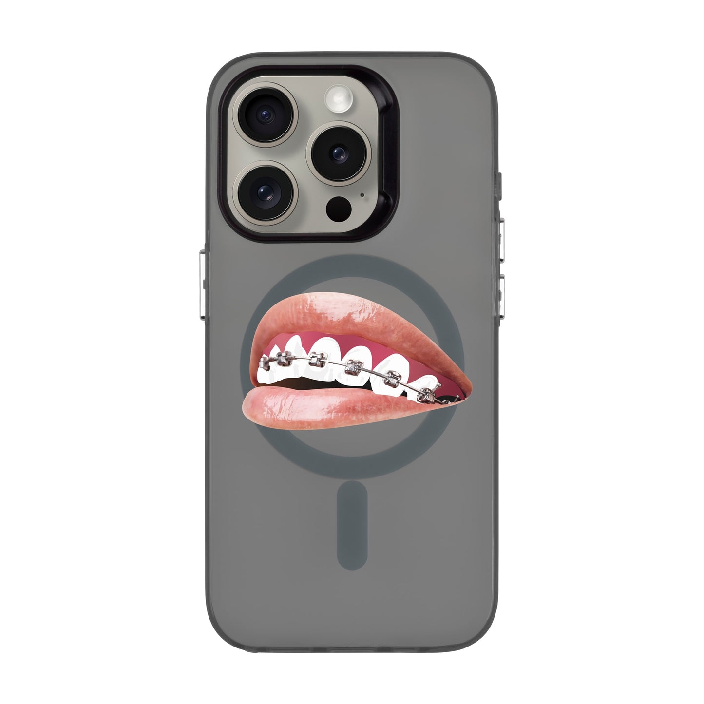 ORTHODONTIST-iPhone 15 Pro Hold Kılıf MagSafe Özellikli