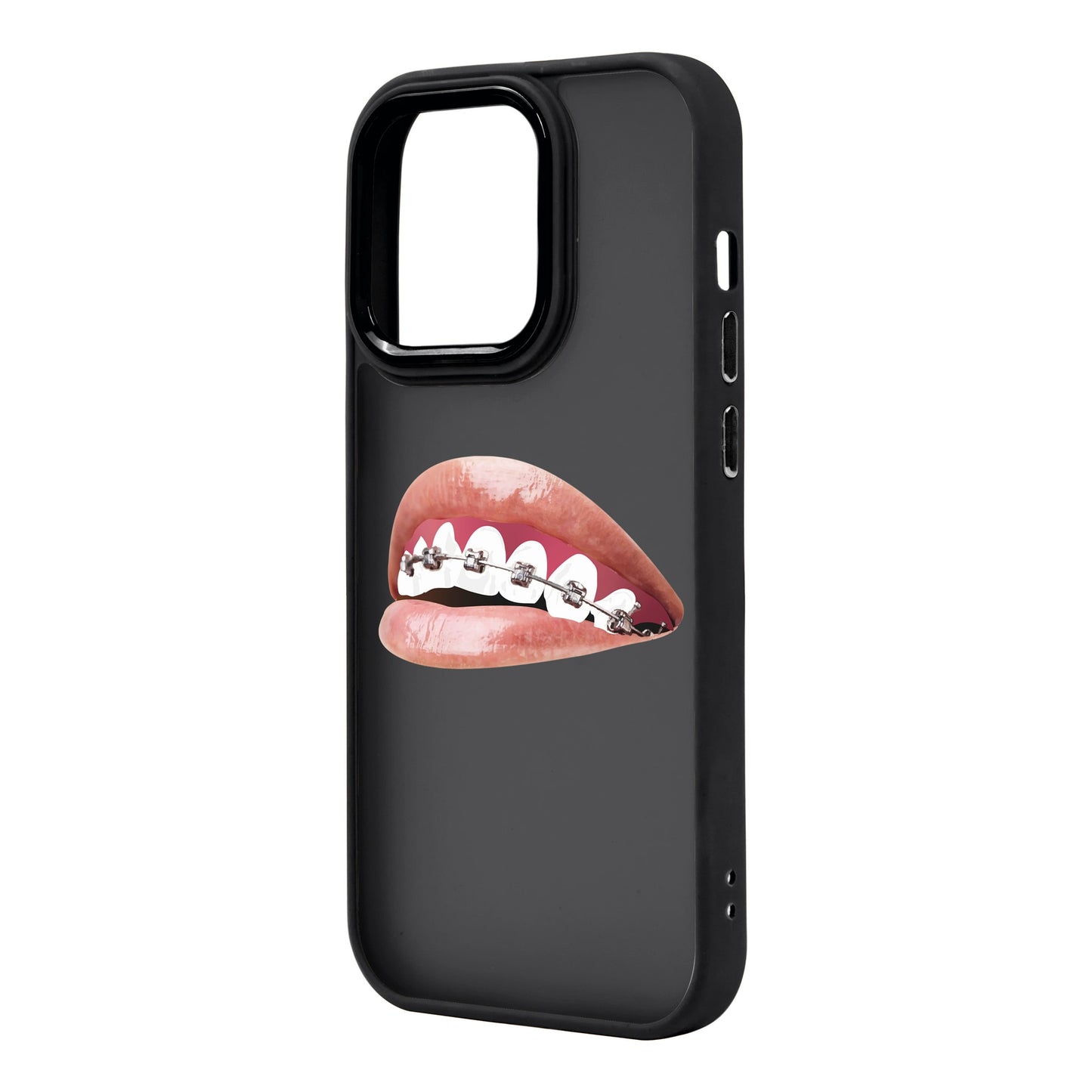 ORTHODONTIST-iPhone 14 Pro Max Proof Kılıf