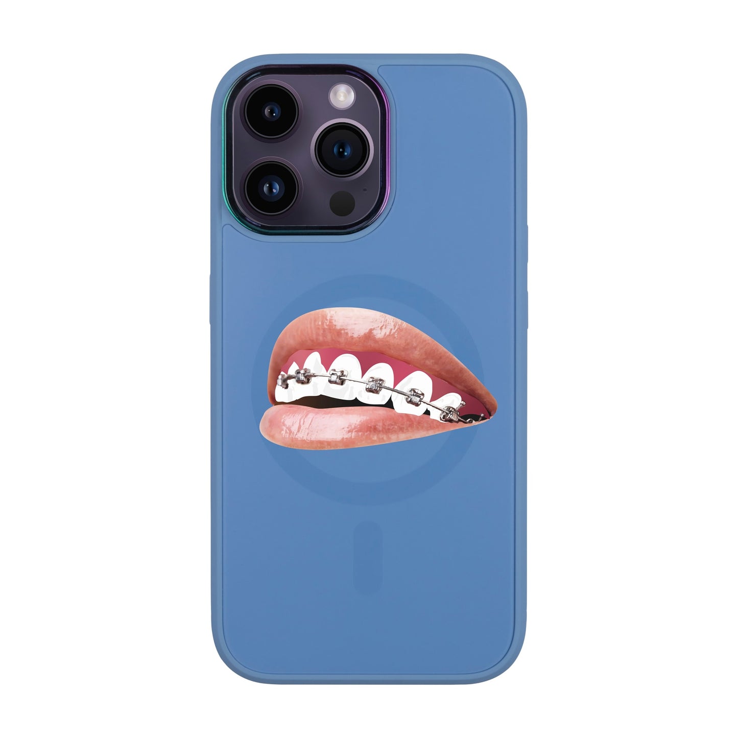 ORTHODONTİST-iPhone 14 Pro Max Vigor Kılıf MagSafe Özellikli