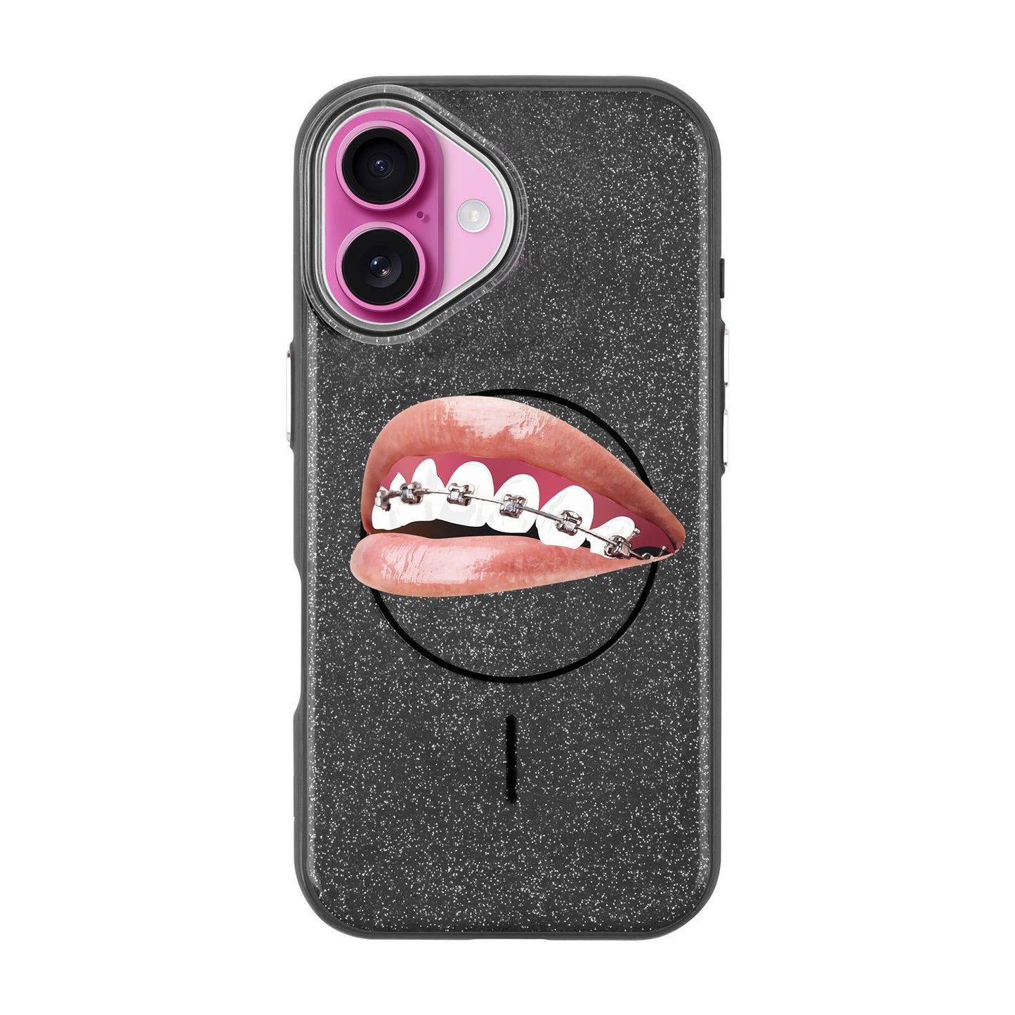 ORTHODONTIST-iPhone 16 Radiant Kılıf MagSafe Özellikli