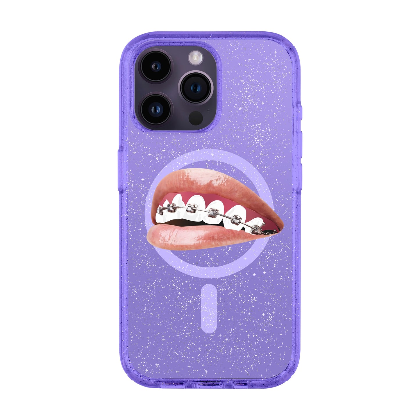 ORTHODONTIST-iPhone 14 Pro Max Shiny Kılıf MagSafe Özellikli