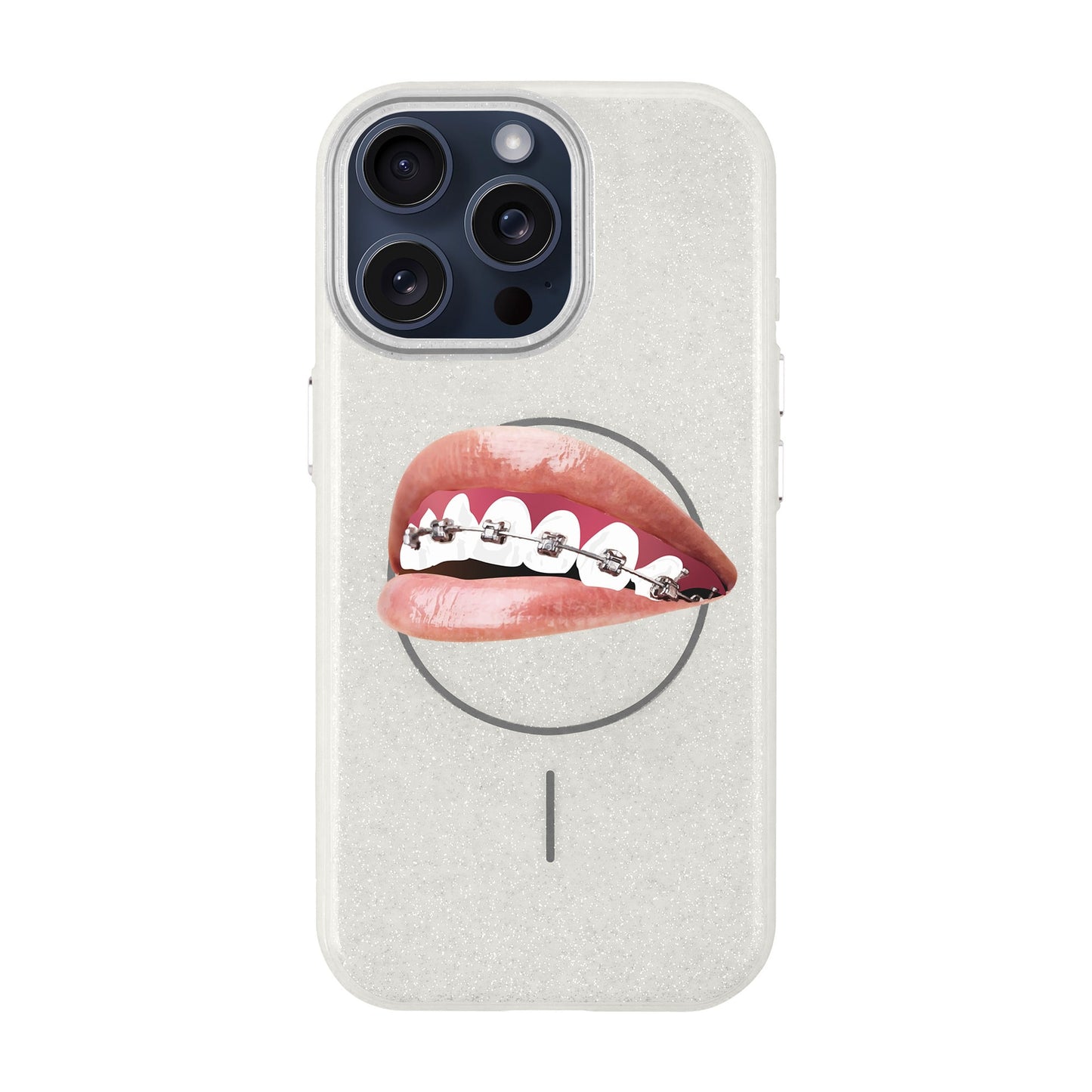ORTHODONTIST-iPhone 15 Pro Max Radiant Kılıf MagSafe Özellikli