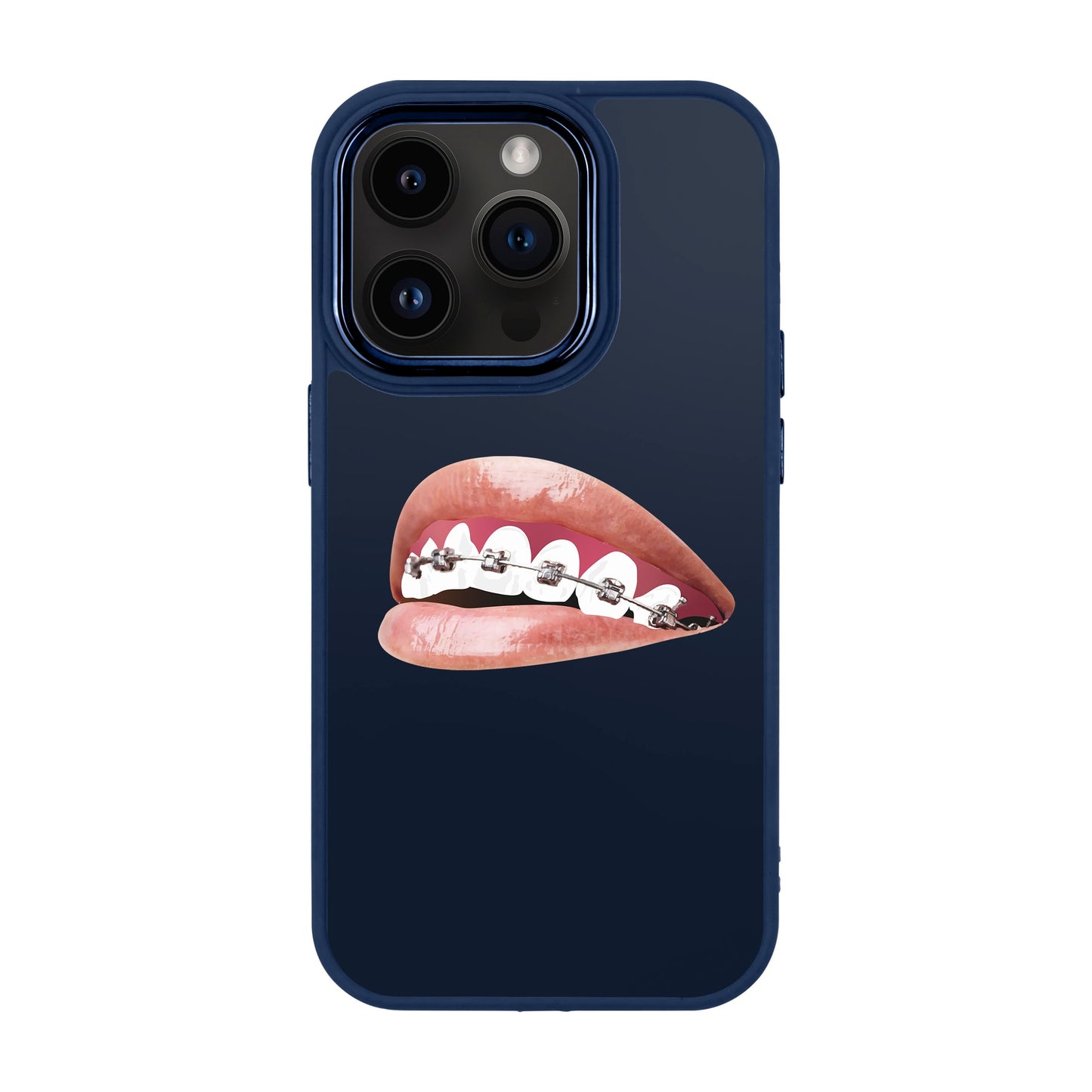 ORTHODONTIST-iPhone 14 Pro Proof Kılıf