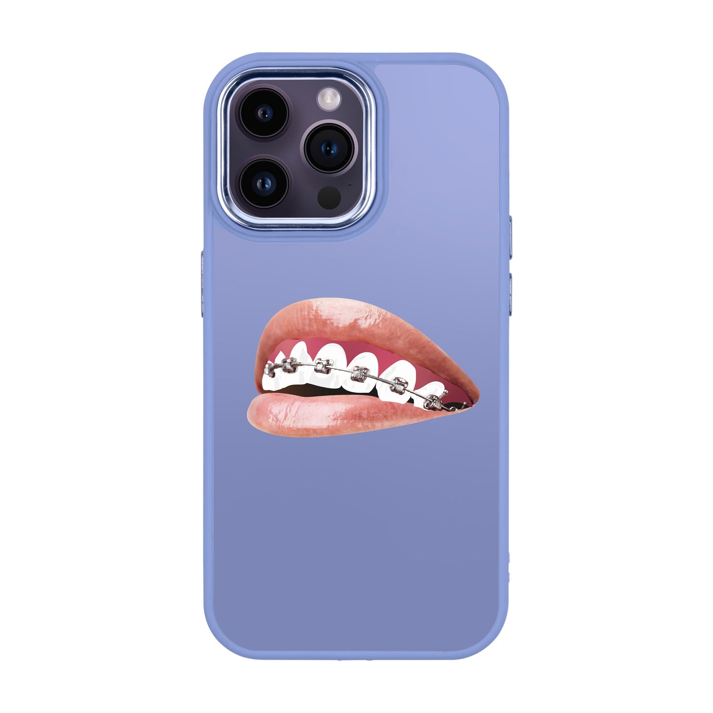 ORTHODONTIST-iPhone 14 Pro Max Proof Kılıf