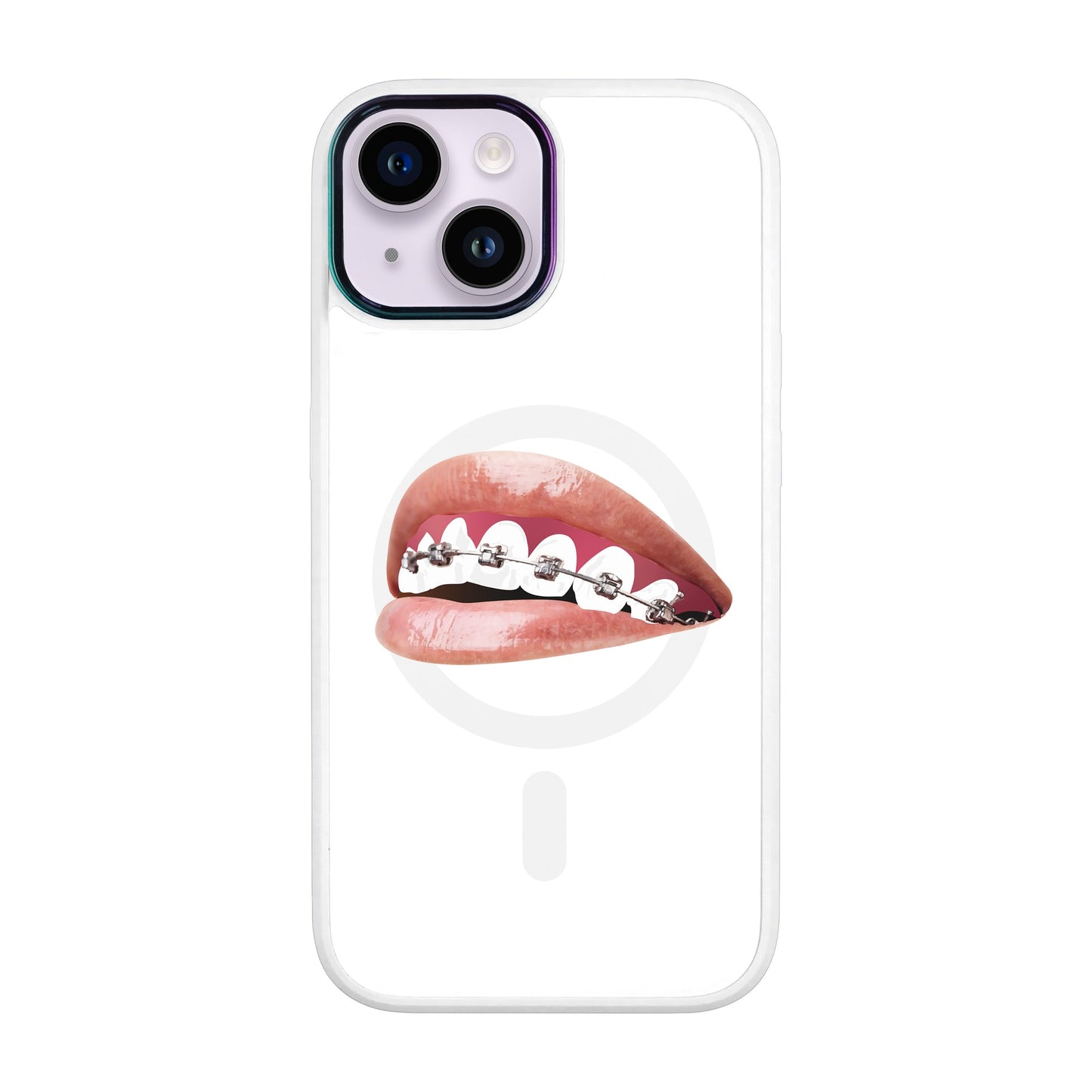 ORTHODONTİST-iPhone 12 Vigor Kılıf MagSafe Özellikli