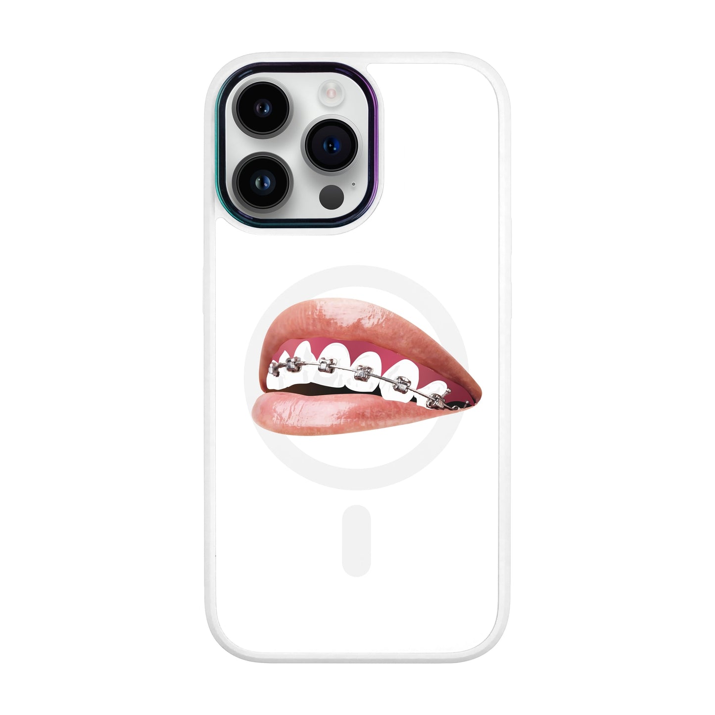 ORTHODONTİST-iPhone 14 Pro Max Vigor Kılıf MagSafe Özellikli