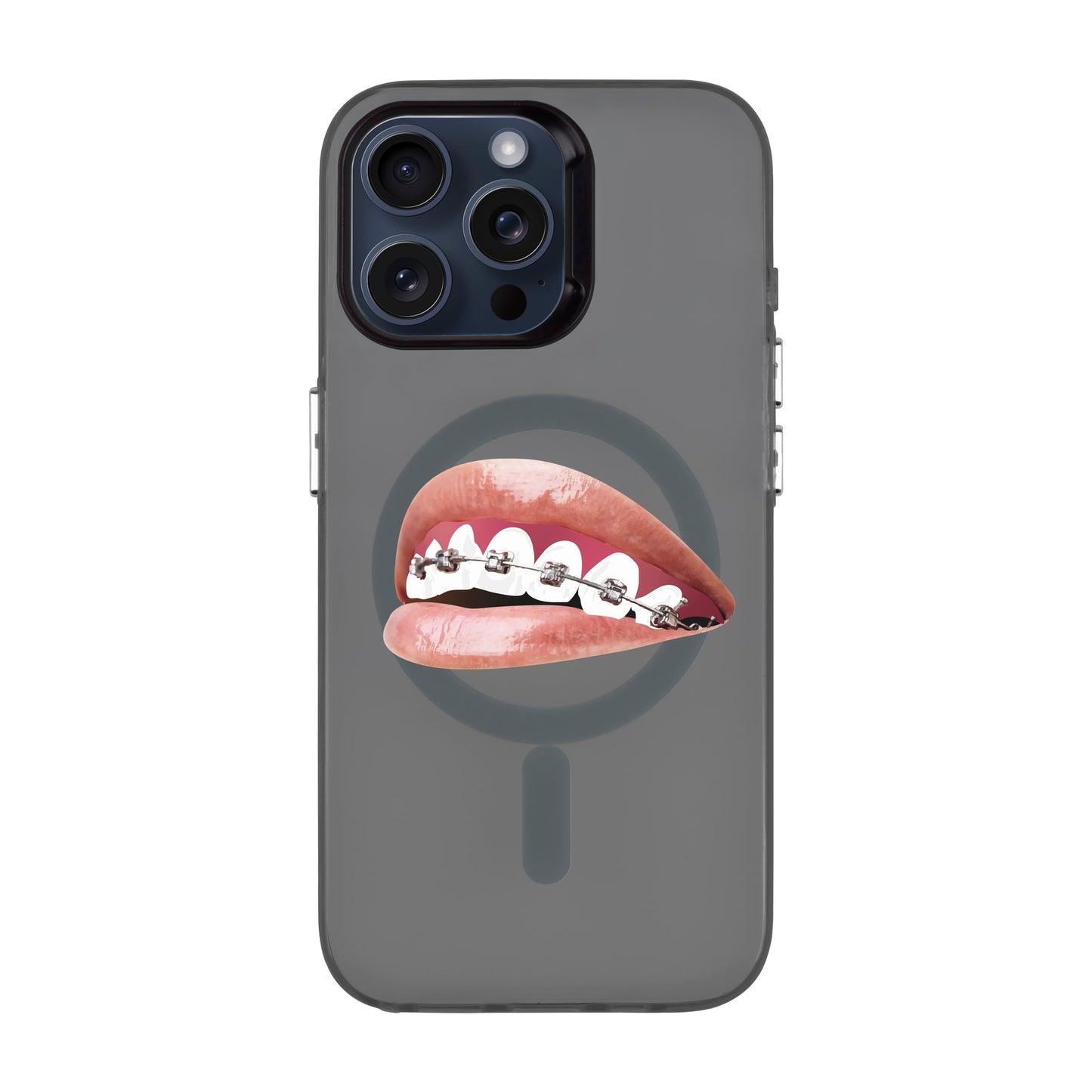ORTHODONTIST-iPhone 15 Pro Max Hold Kılıf MagSafe Özellikli