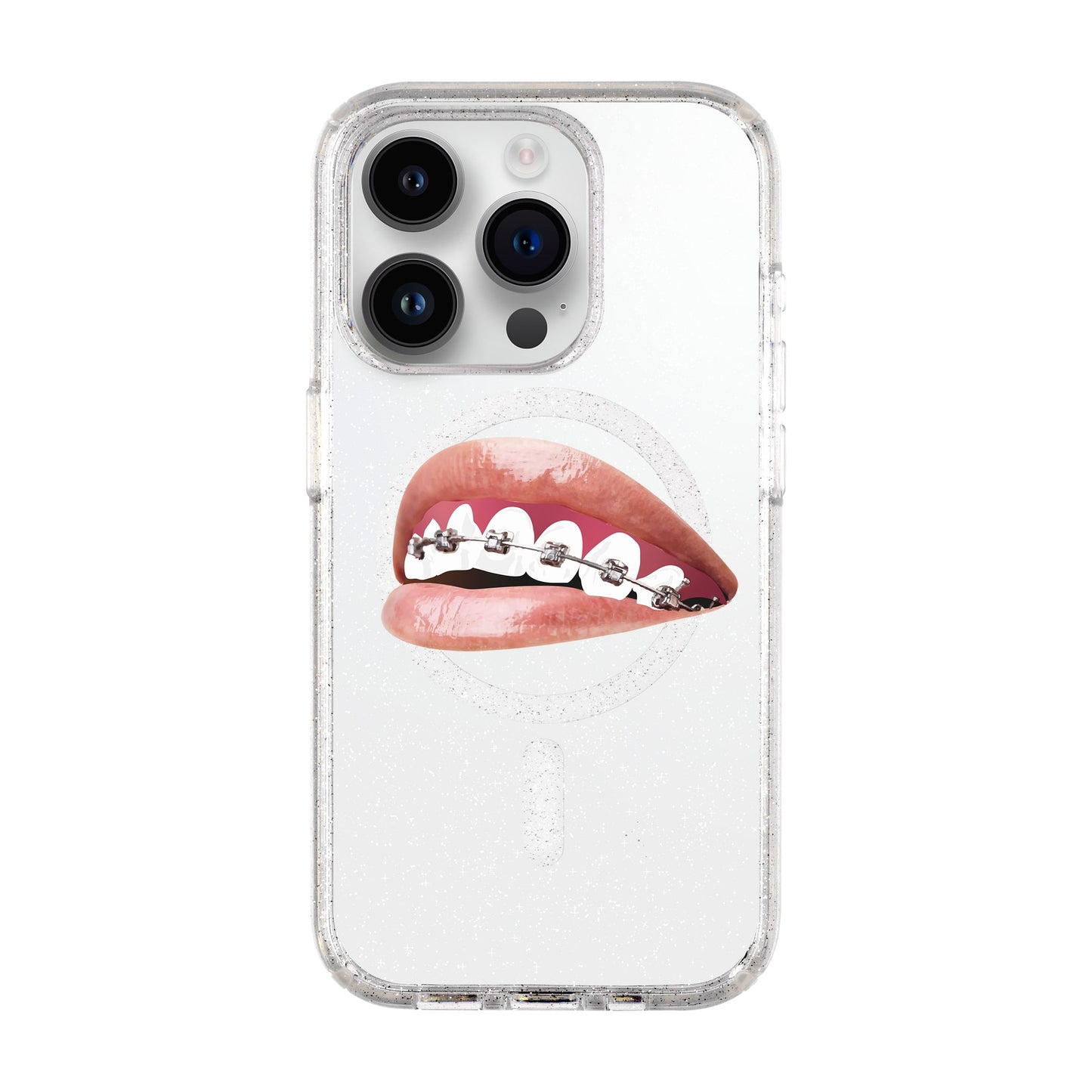 ORTHODONTIST-iPhone 14 Pro Shiny Kılıf MagSafe Özellikli