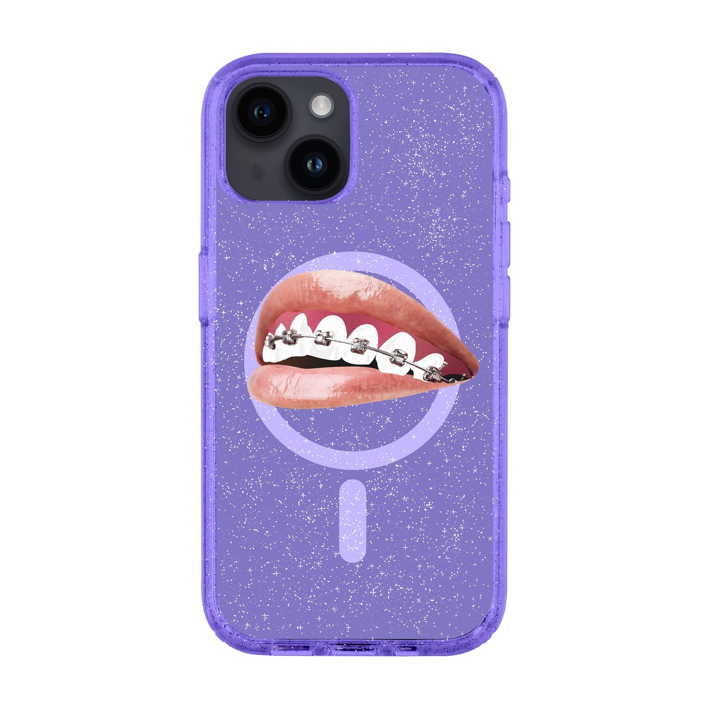 ORTHODONTIST-iPhone 14 Shiny Kılıf MagSafe Özellikli