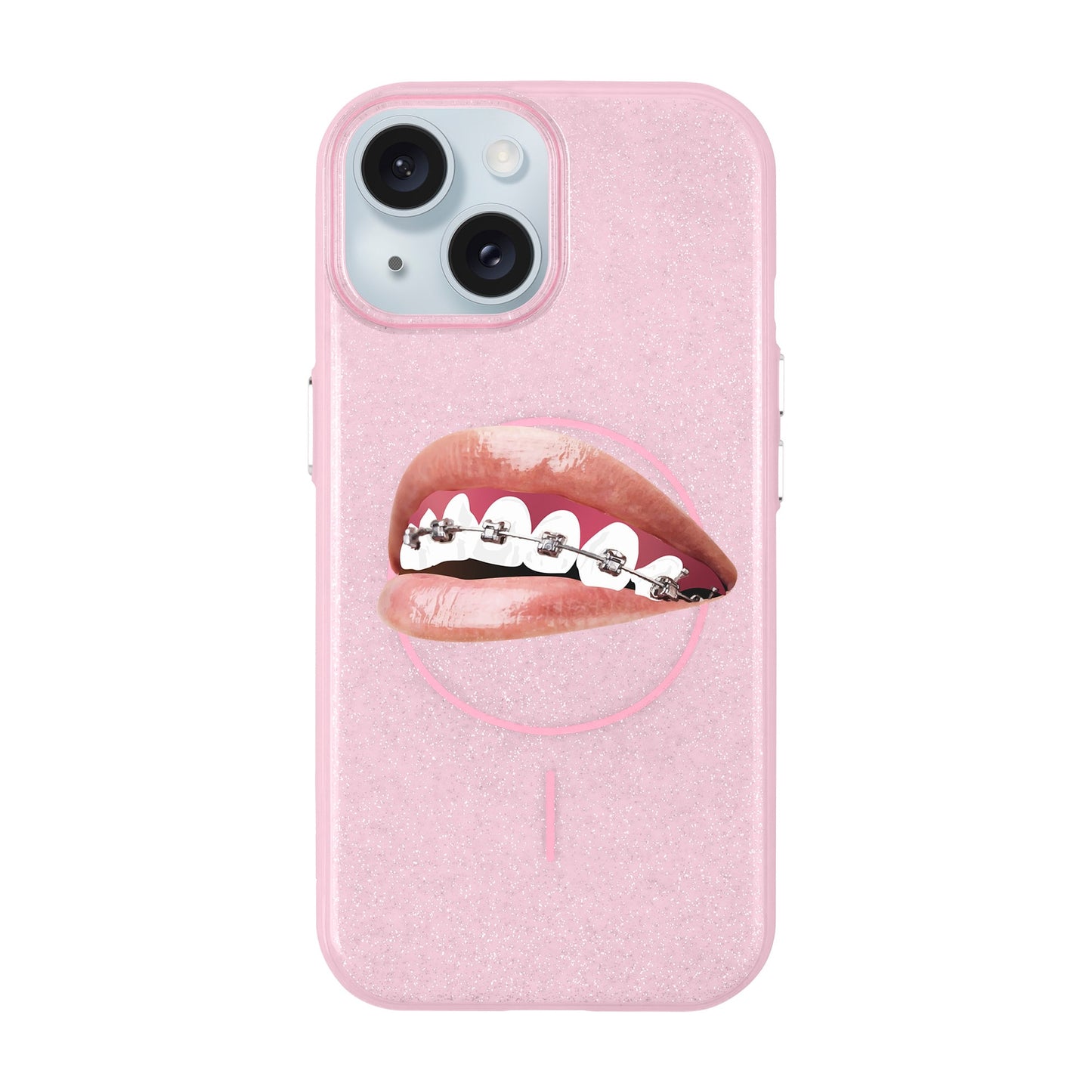 ORTHODONTIST-iPhone 15 Plus Radiant Kılıf MagSafe Özellikli