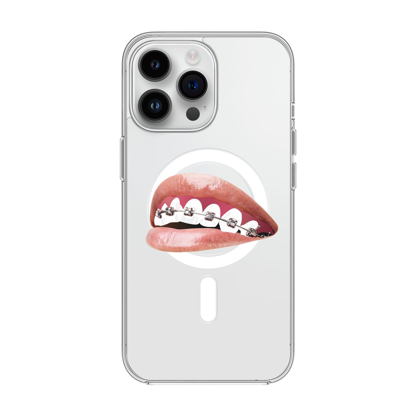 ORTHODONTIST-iPhone 14 Pro Max Solid Kılıf MagSafe Özellikli
