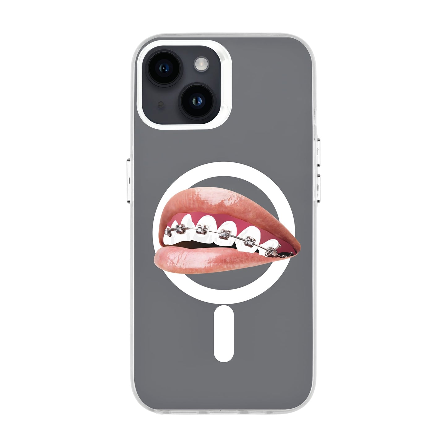 ORTHODONTIST-iPhone 14 Hold Kılıf MagSafe Özellikli