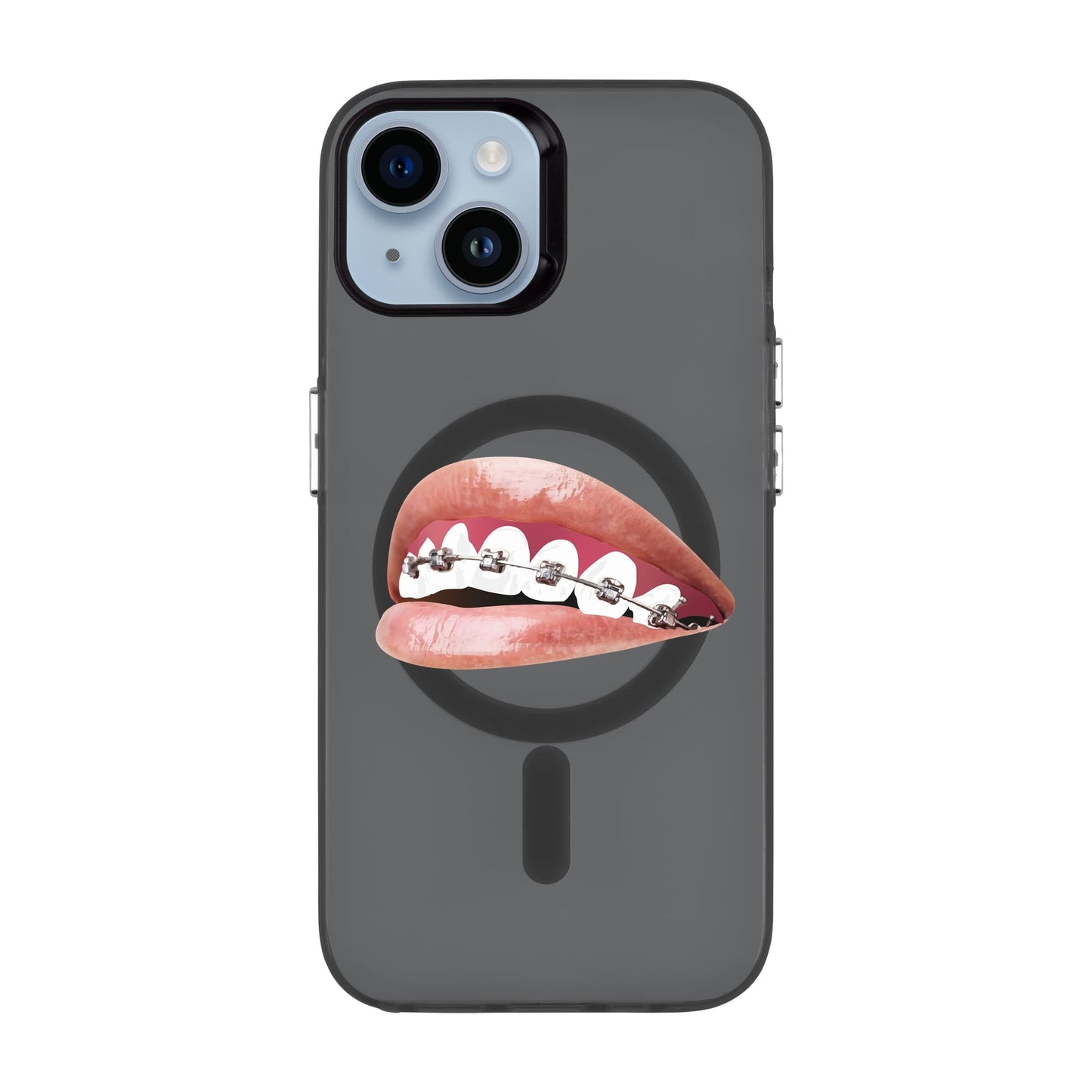 ORTHODONTIST-iPhone 14 Hold Kılıf MagSafe Özellikli