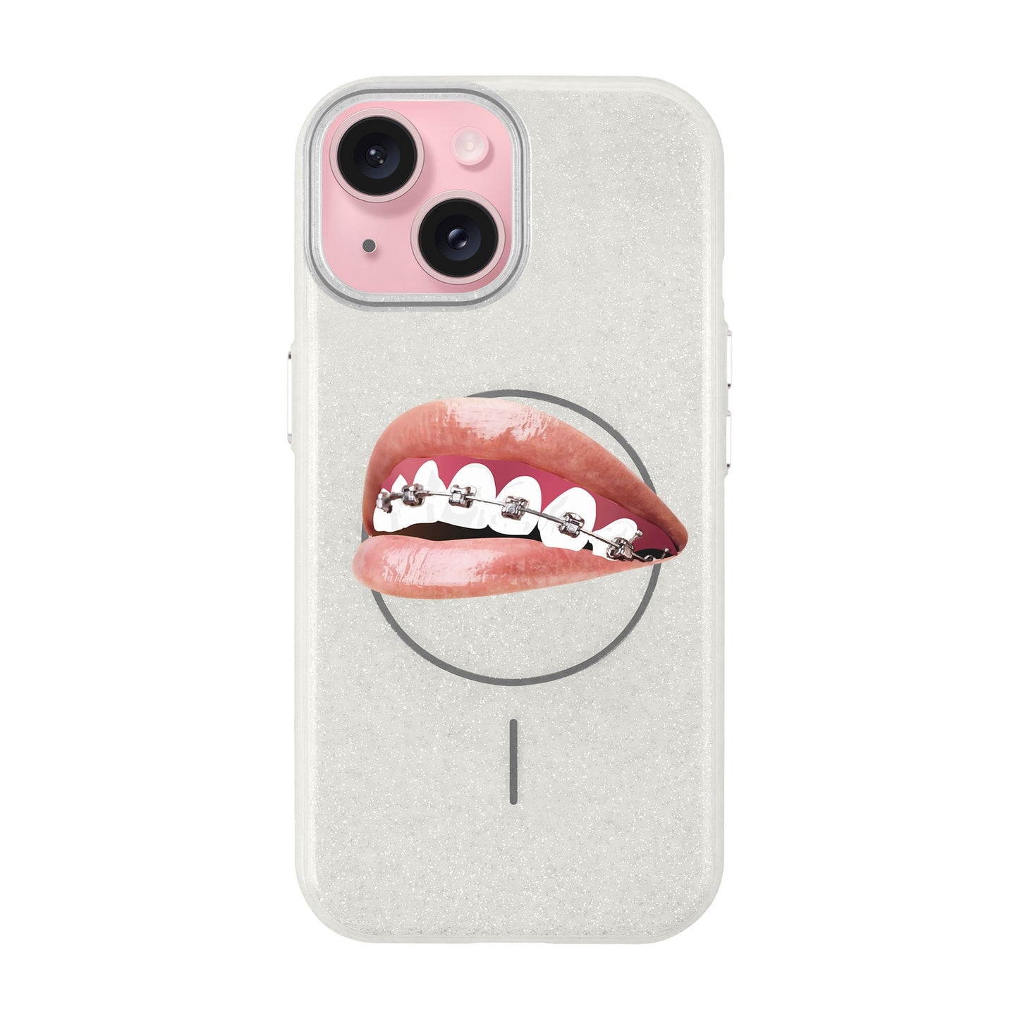 ORTHODONTIST-iPhone 15 Plus Radiant Kılıf MagSafe Özellikli