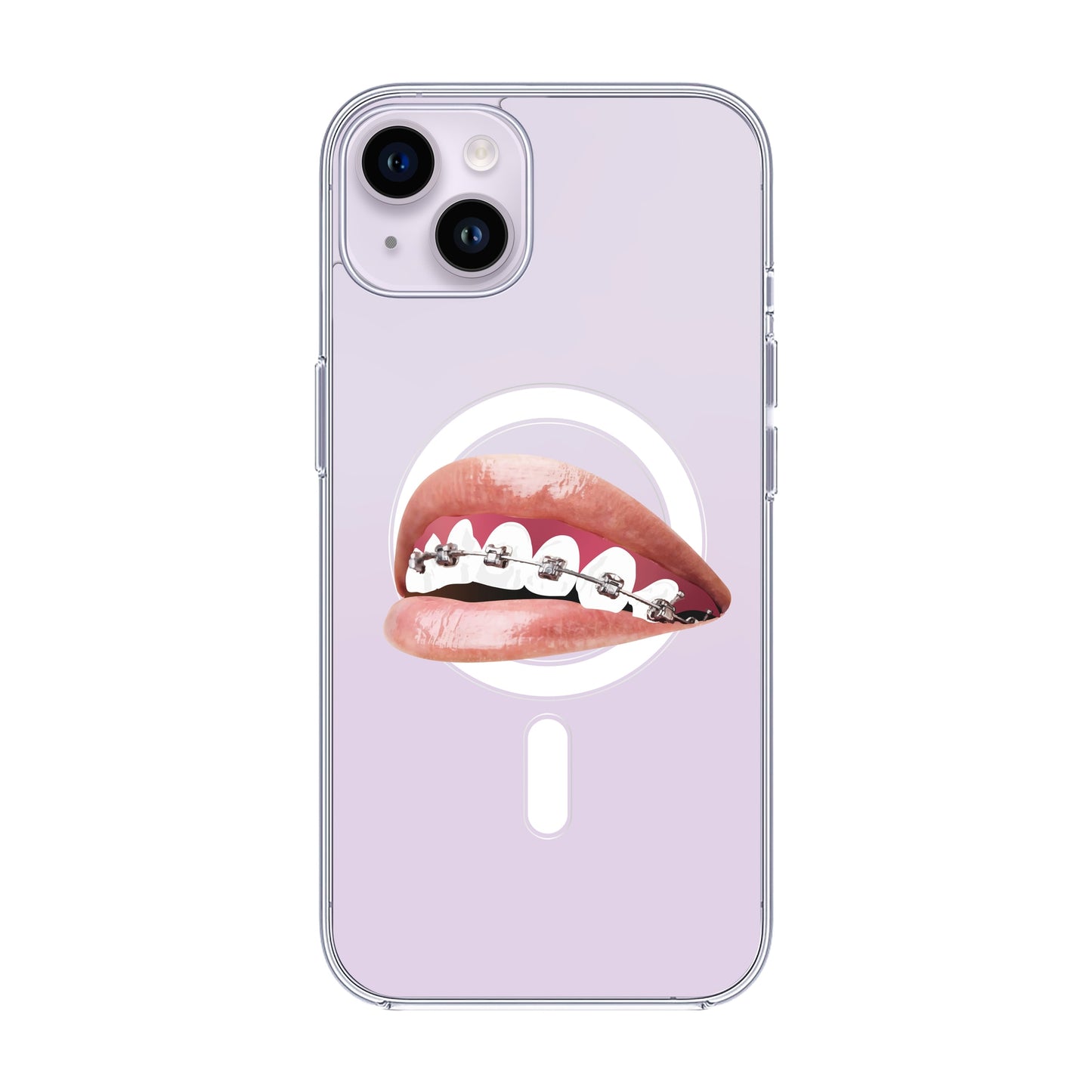 ORTHODONTIST-iPhone 11 Pro Max Solid Kılıf MagSafe Özellikli