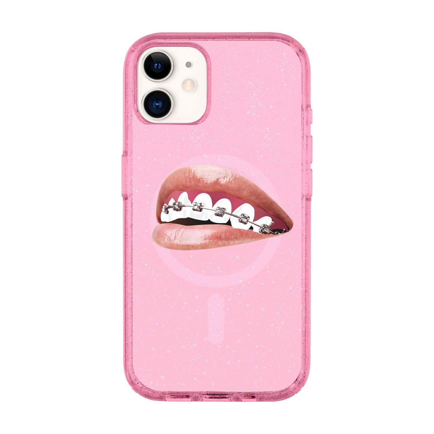 ORTHODONTIST-iPhone 11 Shiny Kılıf MagSafe Özellikli