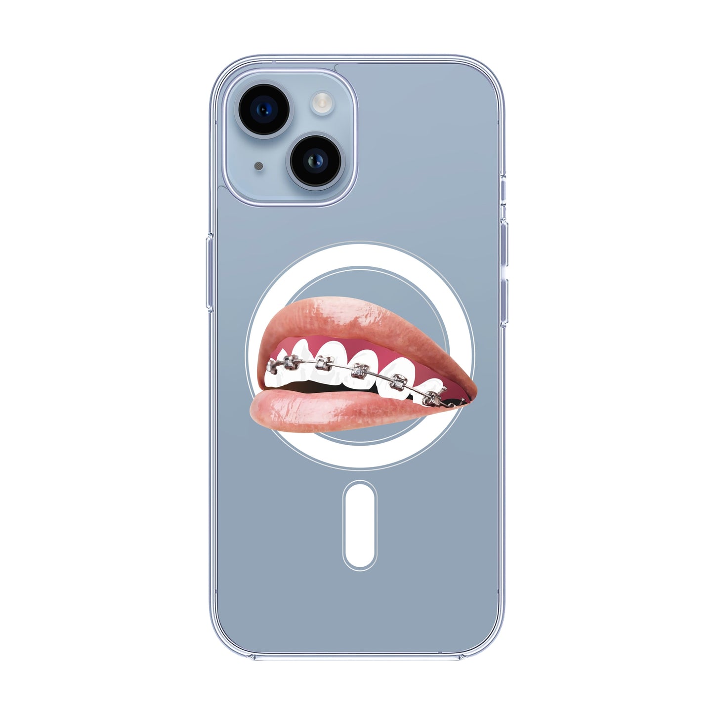 ORTHODONTIST-iPhone 13 Pro Max Solid Kılıf MagSafe Özellikli