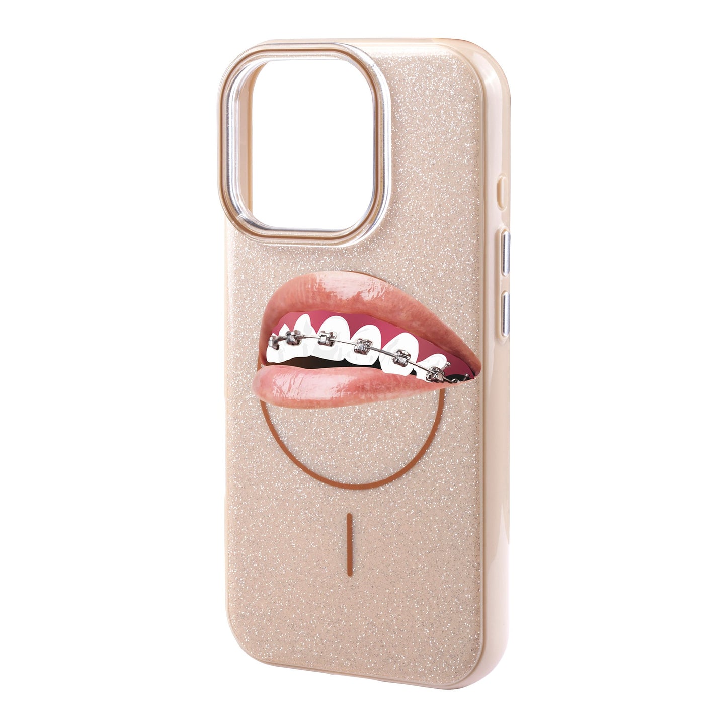 ORTHODONTIST-iPhone 16 Pro Max Radiant Kılıf MagSafe Özellikli