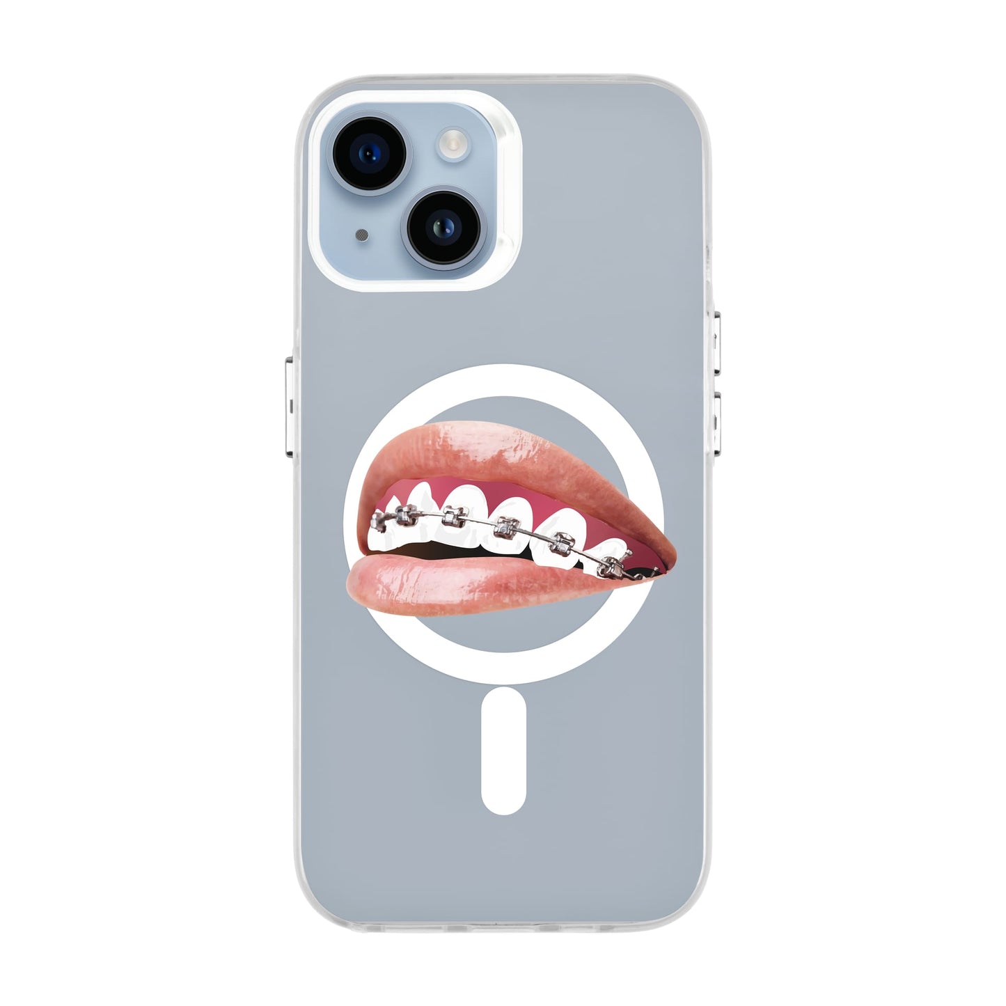 ORTHODONTIST-iPhone 14 Hold Kılıf MagSafe Özellikli