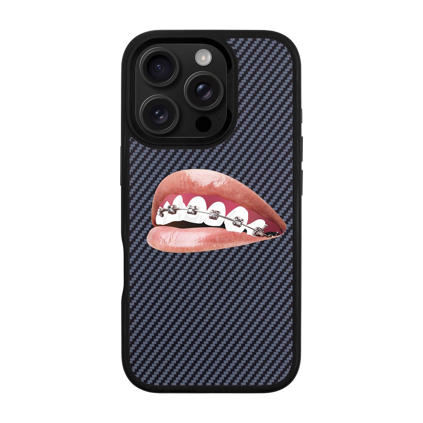 ORTHODONTIST-iPhone 16 Pro Plaid Kılıf MagSafe Özellikli