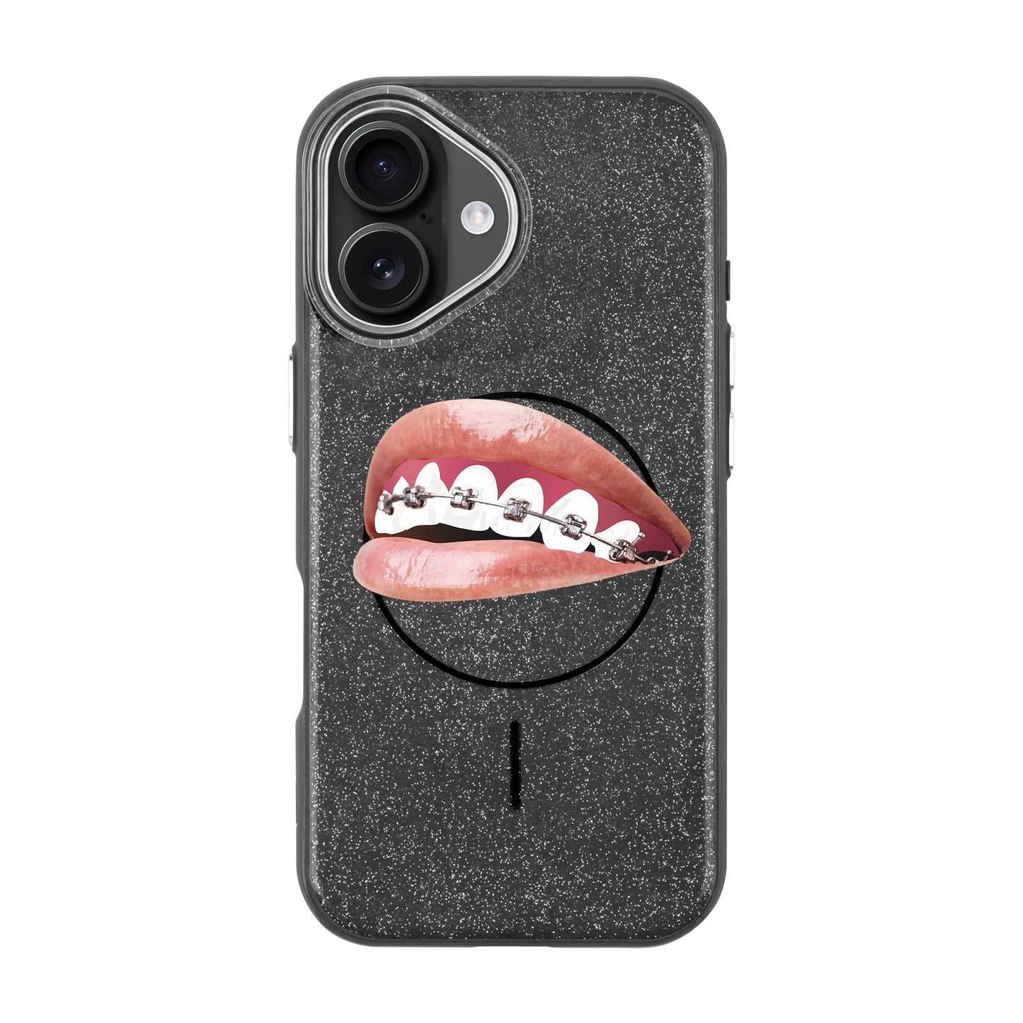 ORTHODONTIST-iPhone 16 Radiant Kılıf MagSafe Özellikli