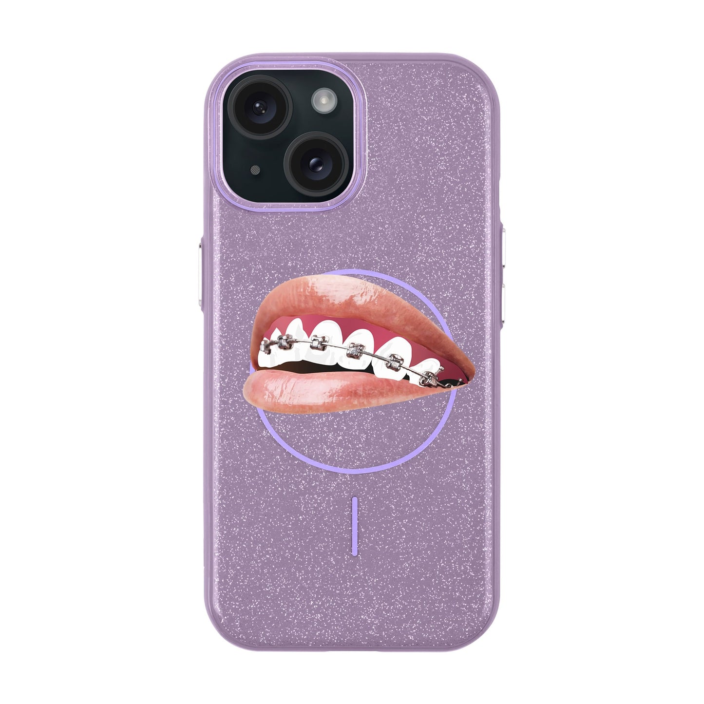 ORTHODONTIST-iPhone 15 Plus Radiant Kılıf MagSafe Özellikli