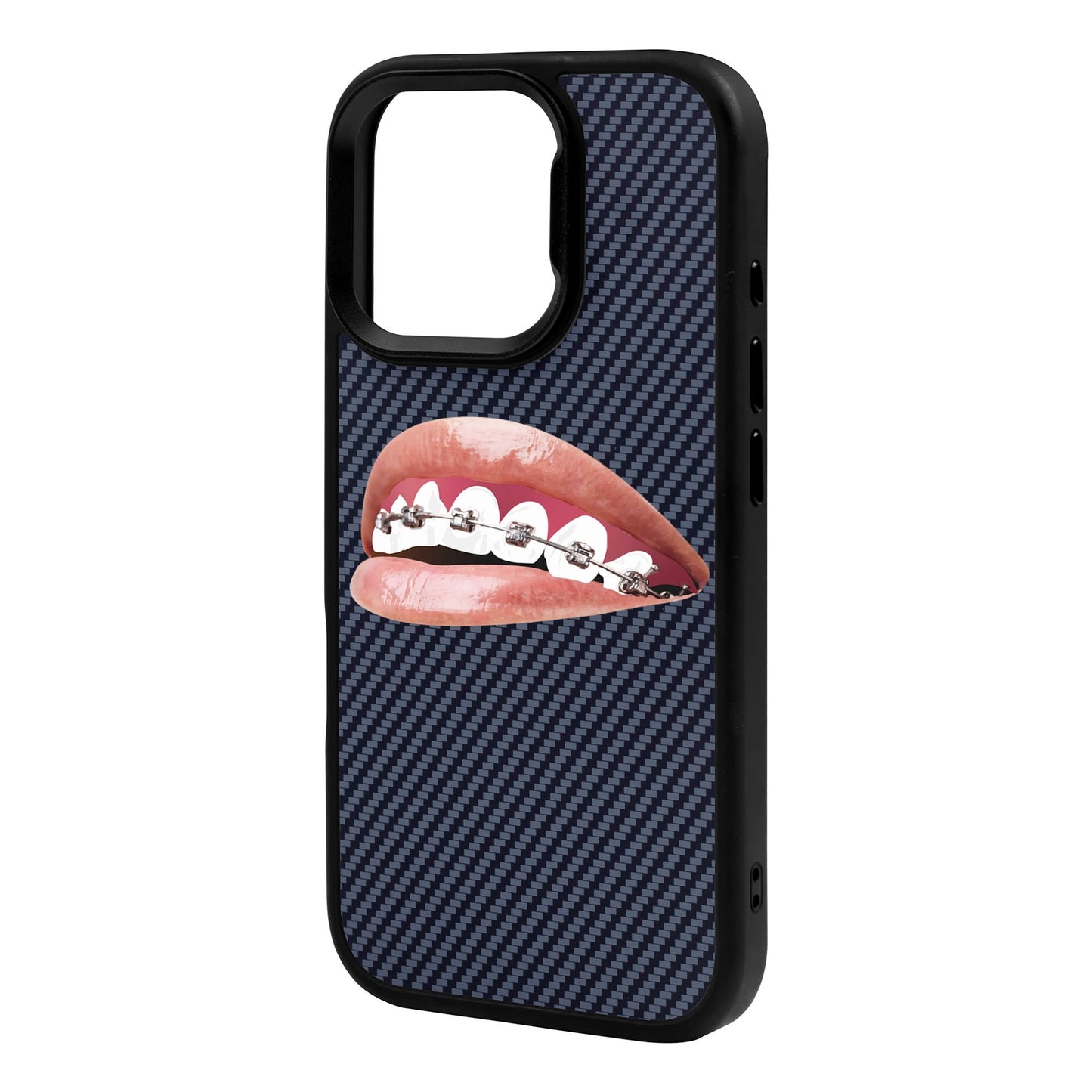 ORTHODONTIST-iPhone 16 Pro Max Plaid Kılıf MagSafe Özellikli