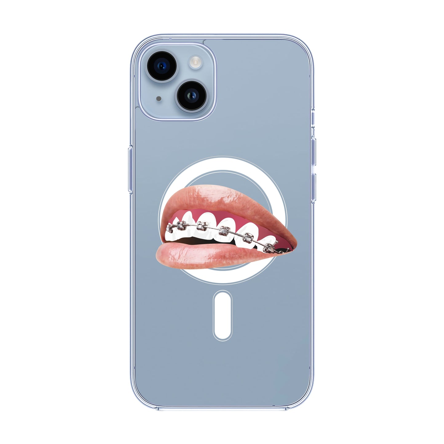 ORTHODONTIST-iPhone 11 Pro Max Solid Kılıf MagSafe Özellikli